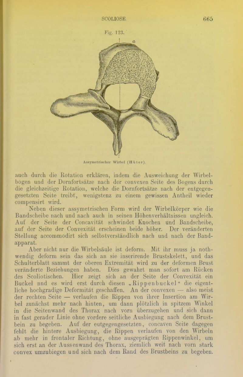 Fig. 123. Assynietrischer Wirbel (Hüter). auch durch die Rotation erklären, indem die Ausweichung der Wirbel- bogen und der Dornfortsätze nach der convexen Seite des Bogens durch die gleichzeitige Rotation, welche die Dornfortsätze nach der entgegen- gesetzten Seite treibt, wenigstenz zu einem gewissen Antheil wieder oompensirt wird. Neben dieser assymetrischen Form wird der Wirbelkörper wie die Bandscheibe nach und nach auch in seinen Höhenverhältnissen ungleich. Auf der Seite der Concavität schwindet Knochen und Bandscheibe, auf der Seite der Convexität erscheinen beide höher. Der veränderten Stellung acoommodirt sich selbstverständlich nach und nach der Band- apparat. Aber nicht nur die Wirbelsäule ist deform. Mit ihr muss ja noth- wendig deform sein das sich an sie inserirende Brustskelctt, und das Schulterblatt sammt der oberen Extremität wird zu der deformen Brust veränderte Beziehungen haben. Dies gewahrt man sofort am Kücken des Scoliotischen. Hier zeigt sich an der Seite der Convexität ein Buckel und es wird erst durch diesen „Rippenbuckelu die eigent- liche hochgradige Deformität geschaffen. An der convexen — also meist der rechten Seite — verlaufen die Rippen von ihrer Insertion am Wir- bel zunächst mehr nach hinten, um dann plötzlich in spitzem Winkel in die Seitenwand des Thorax nach vorn überzugehen und sich dann in fast gerader Linie ohne vordere seitliche Ausbiegung nach dem Brust- bein zu begeben. Auf der entgegengesetzten, coneaven Seite dagegen fehlt die hintere Ausbiegung, die Rippen verlaufen von den Wirbeln ab mehr in frontaler Richtung, ohne ausgeprägten Rippcnwinkel, um sich erst an der Aussenwand des Thorax, ziemlich weit nach vorn stark convex umzubiegen und sich nach dem Rand des Brustbeins zu begeben.