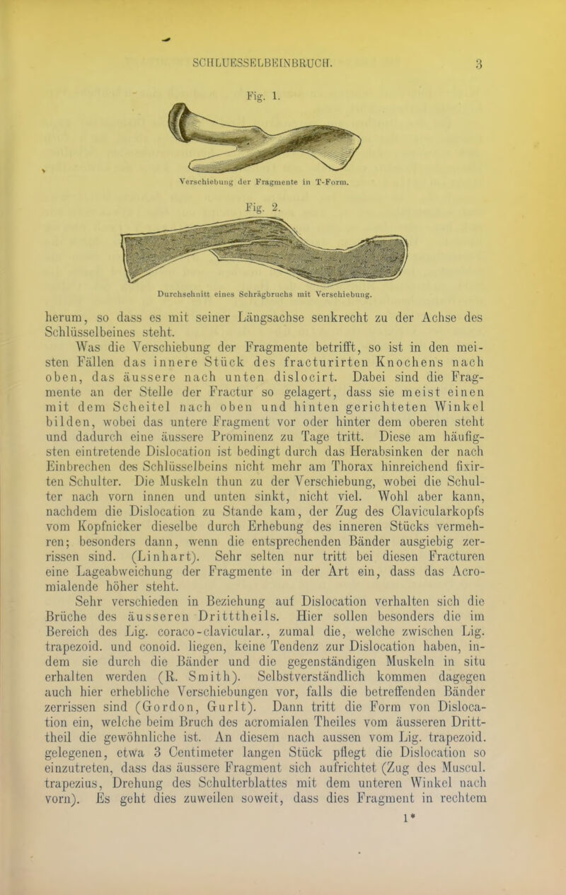 Fig. 1. Verschiebung der Fragmente in T-Form. Fig. 2. Durchschnitt eines Schrägbruchs mit Verschiebung. herum, so dass es mit seiner Längsachse senkrecht zu der Achse des Schlüsselbeines steht. Was die Verschiebung der Fragmente betrifft, so ist in den mei- sten Fällen das innere Stück des fracturirten Knochens nach oben, das äussere nach unten dislocirt. Dabei sind die Frag- mente an der Stelle der Fractur so gelagert, dass sie meist einen mit dem Scheitel nach oben und hinten gerichteten Winkel bilden, wobei das untere Fragment vor oder hinter dem oberen steht und dadurch eine äussere Prominenz zu Tage tritt. Diese am häufig- sten eintretende Dislocation ist bedingt durch das Herabsinken der nach Einbrechen des Schlüsselbeins nicht mehr am Thorax hinreichend fixir- ten Schulter. Die Muskeln thun zu der Verschiebung, wobei die Schul- ter nach vorn innen und unten sinkt, nicht viel. Wohl aber kann, nachdem die Dislocation zu Stande kam, der Zug des Clavicularkopfs vom Kopfnicker dieselbe durch Erhebung des inneren Stücks vermeh- ren; besonders dann, wenn die entsprechenden Bänder ausgiebig zer- rissen sind. (Linhart). Sehr selten nur tritt bei diesen Fracturen eine Lageabweichung der Fragmente in der Art ein, dass das Acro- mialende höher steht. Sehr verschieden in Beziehung auf Dislocation verhalten sich die Brüche des äusseren Dritttheils. Hier sollen besonders die im Bereich des Lig. coraco-clavicular., zumal die, welche zwischen Lig. trapezoid. und conoid. liegen, keine Tendenz zur Dislocation haben, in- dem sie durch die Bänder und die gegenständigen Muskeln in situ erhalten werden (R. Smith). Selbstverständlich kommen dagegen auch hier erhebliche Verschiebungen vor, falls die betreffenden Bänder zerrissen sind (Gordon, Gurlt). Dann tritt die Form von Disloca- tion ein, welche beim Bruch des acromialen Theiles vom äusseren Dritt- theil die gewöhnliche ist. An diesem nach aussen vom Lig. trapezoid. gelegenen, etwa 3 Oentimeter langen Stück pflegt die Dislocation so einzutreten, dass das äussere Fragment sich aufrichtet (Zug des Museal, trapezius, Drehung des Schulterblattes mit dem unteren Winkel nach vorn). Es geht dies zuweilen soweit, dass dies Fragment in rechtem 1*