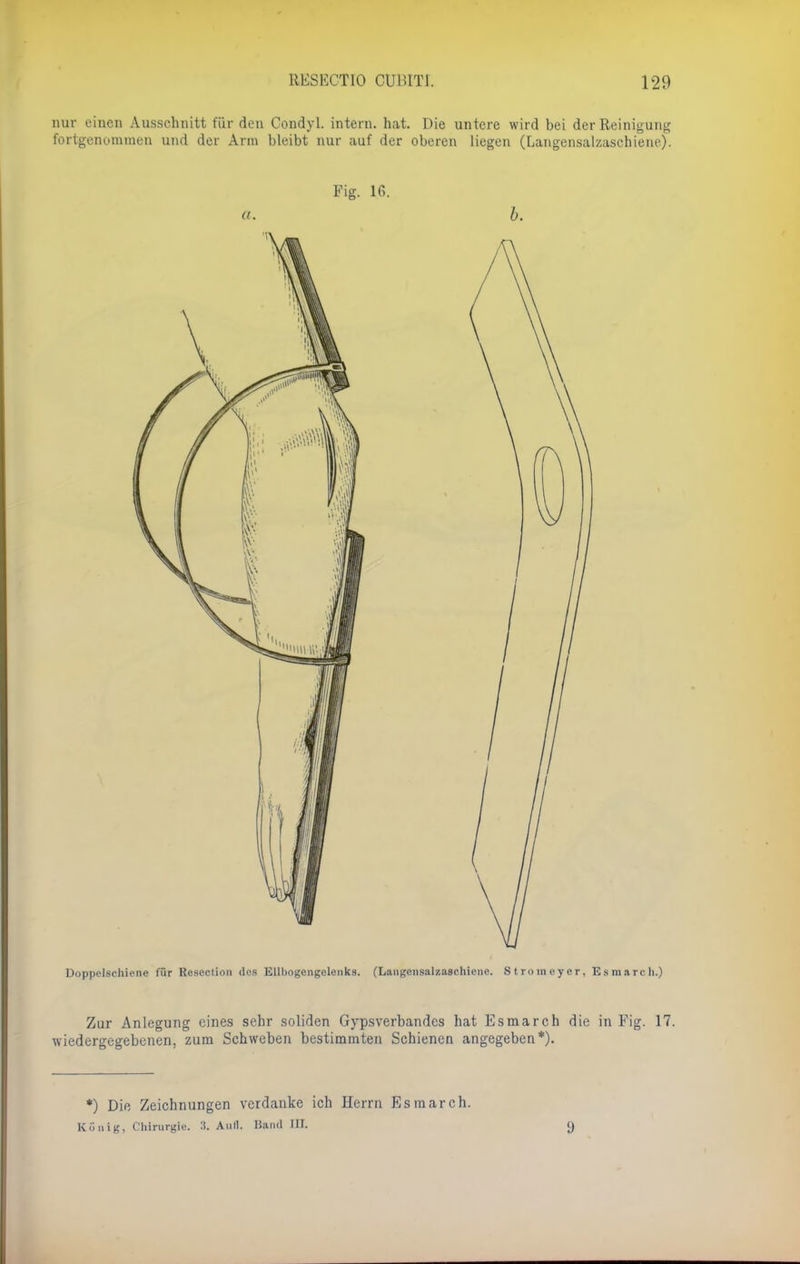 nur einen Ausschnitt für den Condyl. intern, hat. Die untere wird bei der Reinigung fortgenommen und der Arm bleibt nur auf der oberen liegen (Langensalzaschiene). Fig. 16. a. b. Doppelschiene für Resection des Ellbogengelenks. (Limgen.snl/.asehiene. Stromeyer, Esraarch.) Zur Anlegung eines sehr soliden Gypsverbandes hat Es mar eh die in Fig. 17. wiedergegebenen, zum Schweben bestimmten Schienen angegeben*). *) Die Zeichnungen verdanke ich Herrn Esmarch. König, Chirurgie. 3. Aufl. Band III. 9