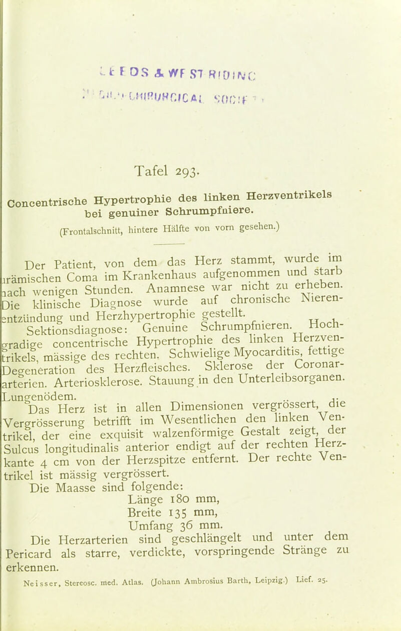 i F OS A V/F S7 RfOlNC V CMIRUHCICAI $OC!f Tafel 293. Concentrische Hypertrophie des linken Herzventrikels bei genuiner Schrumpfmere. (Frontalschnitt, hintere Hälfte von vorn gesehen.) Der Patient, von dem das Herz stammt, wurde im hämischen Coma im Krankenhaus aufgenommen und starb ,ach wenigen Stunden. Anamnese war nicht zu erheben. Die klinische Diagnose wurde auf chronische Nieren- ntzündung und Herzhypertrophie gestellt. _ Sektionsdiagnose: Genuine Schrumpfnieren Hoch- gradige concentrische Hypertrophie des linken Herzven- trikels massige des rechten. Schwielige Myocarditis, fettige Degeneration des Herzfleisches. Sklerose der Coronar- arterien. Arteriosklerose. Stauung in den Unterleibsorganen. Lungenödem. , .. Das Herz ist in allen Dimensionen vergrossert, die Vergrößerung betrifft im Wesentlichen den linken Ven- trikel der eine exquisit walzenförmige Gestalt zeigt der Sulcus longitudinalis anterior endigt auf der rechten Herz- kante 4 cm von der Herzspitze entfernt. Der rechte Ven- trikel ist massig vergrossert. Die Maasse sind folgende: Länge 180 mm, Breite 135 mm, Umfang 36 mm. Die Herzarterien sind geschlängelt und unter dem Pericard als starre, verdickte, vorspringende Stränge zu erkennen.