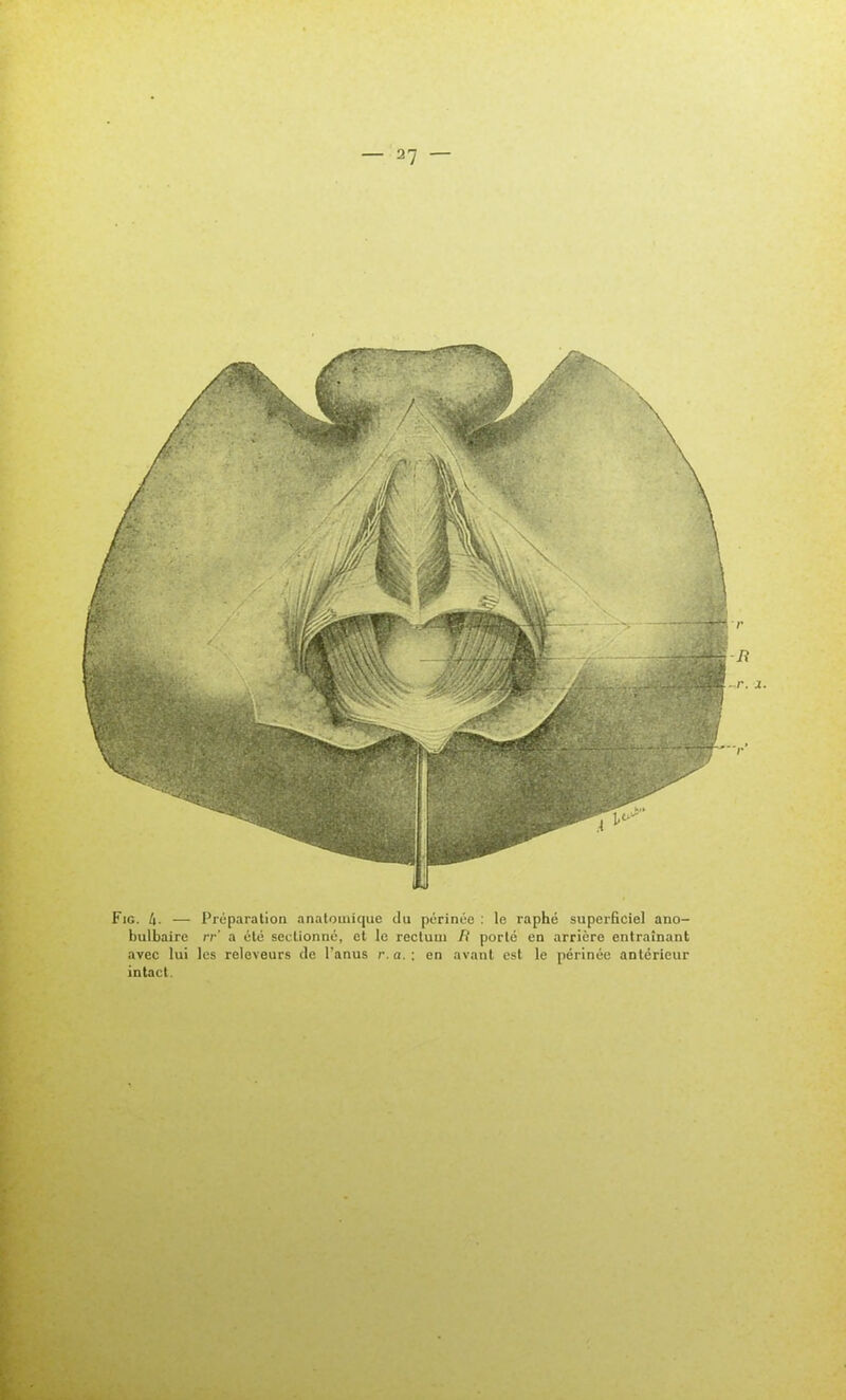 FiG. t). — Préparation anatouiique du périnée : le raphé superficiel ano- bulbaire rr' a été sectionné, cl le rectum fi porté en arrière entraînant avec lui les releveurs de l'anus r.a.; en avant est le périnée antérieur intact.