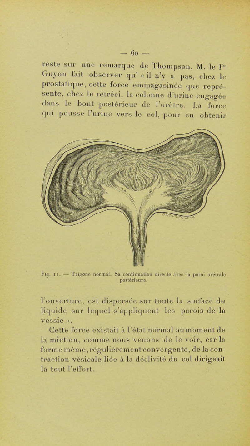 reste sur une remarque de Thompson, M. le Guyon fait observer qu' ail n'y a pas, chez le prostatique, cette force emmagasinée que repré- sente, chez le rétréci, la colonne d'urine engagée dans le bout postérieur de l'urètre. I.a force qui pousse l'urine vers le col, pour en obtenir FiG. II. — Trigono normal. Sa continuation directe avec la paroi urétrale postérieure. l'ouverture, est dispersée sur toute la surface du liquide sur lequel s'ajipliquent les parois de la vessie ». Cette force existait à l'état normal au moment de la miction, comme nous venons de le voir, car la forme môme, régulièrement convergente, de la con- traction vésicale liée à la déclivité du col dirigeait là tout l'effort.
