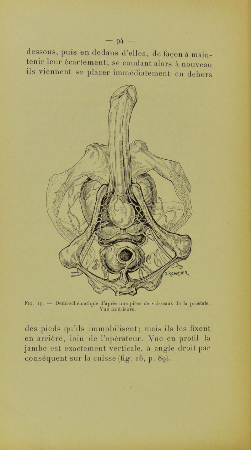 - - dessons, puis en dedans d'elles, de façon à main- tenir leur écarlement; se coudant alors à nouveau ils viennent se placer immédiatement en dehors FiG. 19. — Demi-schématique d'après une pièce de vaisseaux de la prostate. Vue inférieure. des pieds qu'ils immobilisent; mais ils les fixent en arrière, loin de l'opérateiu. Vue en profil la jambe est exactement verticale, à angle droit par conséquent sur la cuisse (fig. 16, p. 89).