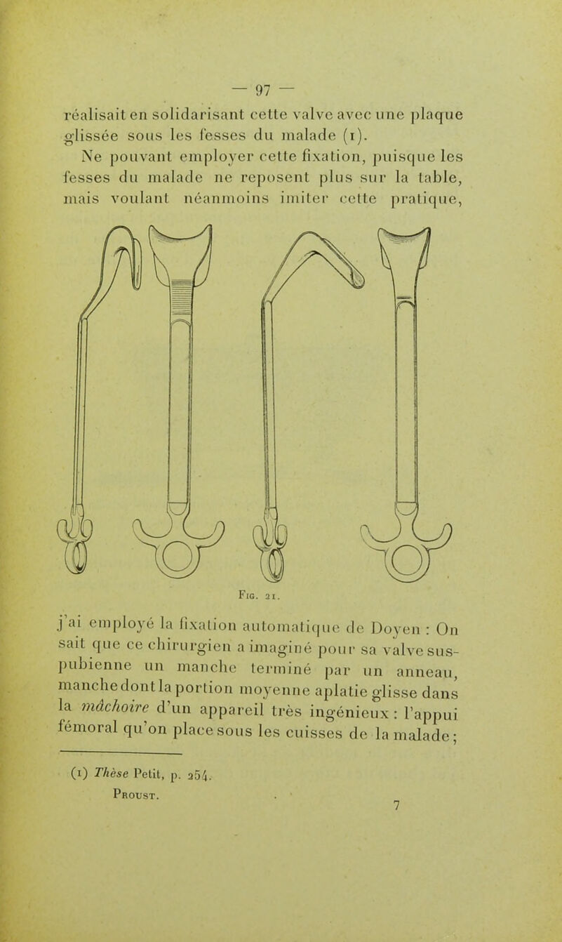 réalisait en solidarisant eette valve avec une plaque glissée sous les fesses du malade (i). Ne pouvant employer cette fixation, puisque les fesses du malade ne reposent plus sur la table, mais voulant néanmoins imiter cette pratique, FiG. 21. j'ai employé la fixation automalicpie de Doyen : On sait que ce chirurgien a imaginé pour sa valve sus- ])ubienne un manche terminé par un anneau, manche dont la portion moyenne aplatie glisse dans la mâchoire d'un appareil très ingénieux : l'appui fémoral qu'on place sous les cuisses de la malade; (i) Thèse l^elit, p. aô^. Proust. 7