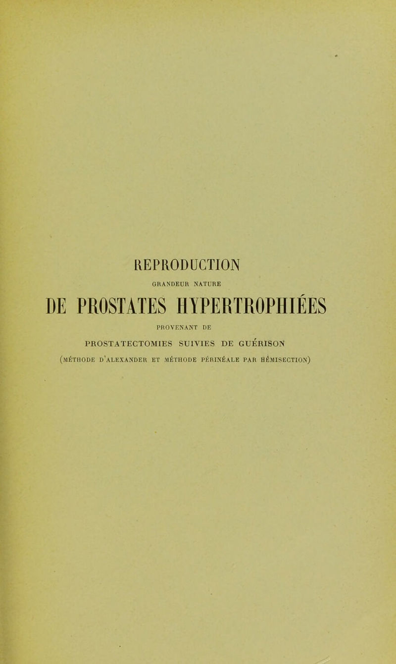 REPRODUCTION ORANDEUH NATURE DE PROSTATES HYPERTROPHIÉES PROVENANT DE PROSTATECTOMIES SUIVIES DE GUÉRISON (méthode d'alexander et méthode périnéale par hémisection)