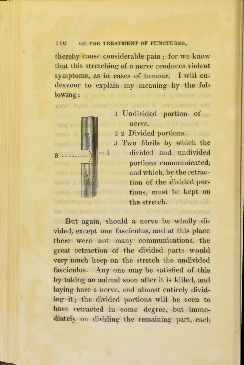 thereby cause considerable pain ; for we know that this stretching- of a nerve produces violent symptoms, as in cases of tumour. I will en- deavour to explain my meaning- by the fol- lowing- : 1 Undivided portion of nerve. 2 2 Divided portions. 3 Two fibrils by which the 1 divided and undivided portions communicated, and which, by the retrac- tion of the divided por- tions, must be kept on the stretch. But again, should a nerve be wholly di- vided, except one fasciculus, and at this place there were not many communications, the great retraction of the divided parts would very much keep on the stretch the undivided fasciculus. Any one may be satisfied of this by taking an animal soon after it is killed, and laying bare a nerve, and almost entirely divid- ing it; the divided portions will be seen to have retracted in some degree, but imme- diately on dividing the remaining part, each