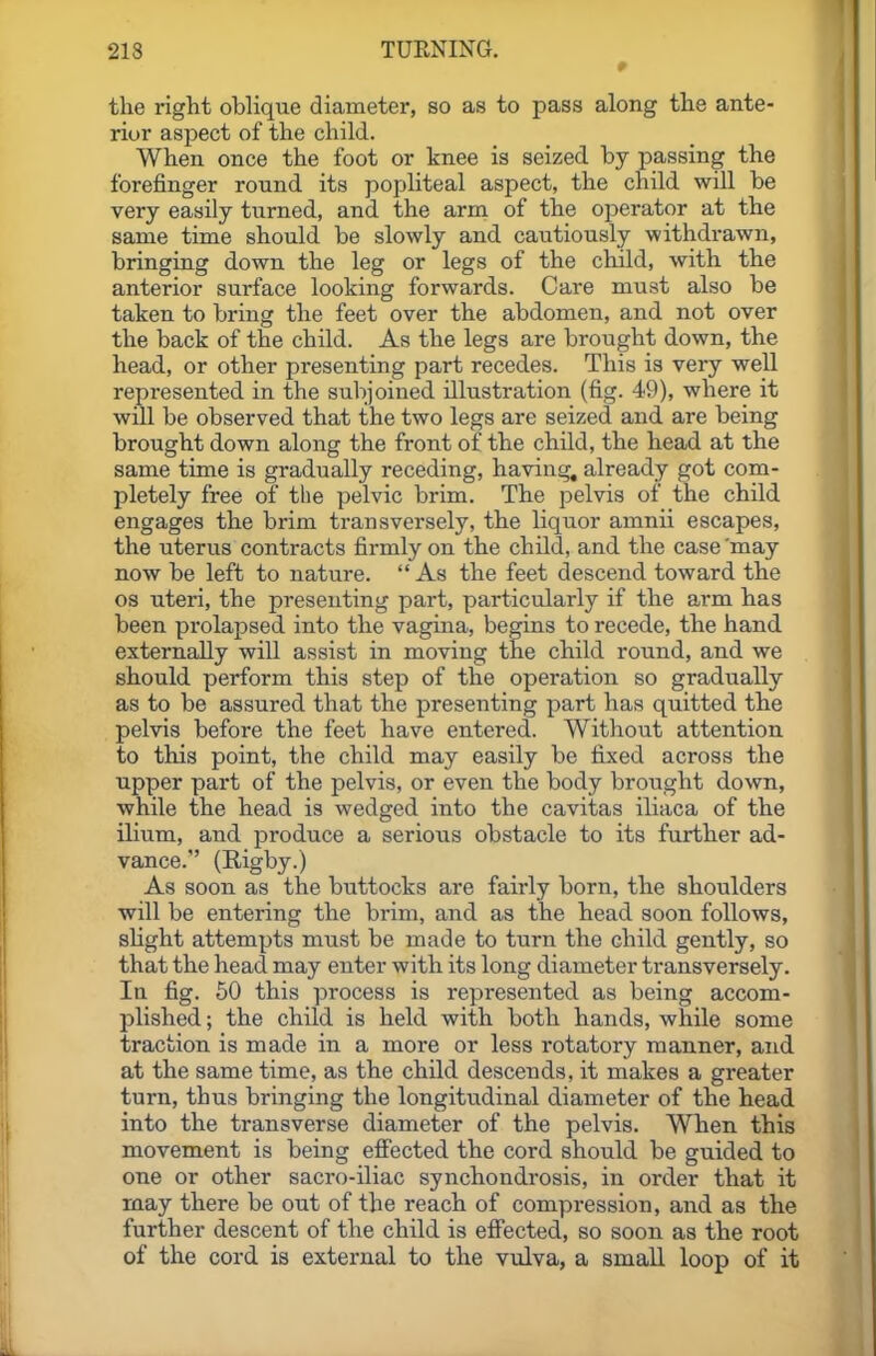 the right oblique diameter, so as to pass along the ante- rior aspect of the child. When once the foot or knee is seized by passing the forefinger round its popliteal aspect, the child will be very easily turned, and the arm of the operator at the same time should be slowly and cautiously withdrawn, bringing down the leg or legs of the child, with the anterior surface looking forwards. Care must also be taken to bring the feet over the abdomen, and not over the back of the child. As the legs are brought down, the head, or other presenting part recedes. This is very well represented in the subjoined illustration (fig. 49), where it will be observed that the two legs are seized and are being brought down along the front of the child, the head at the same time is gradually receding, having, already got com- pletely free of the pelvic brim. The pelvis of the child engages the brim transversely, the liquor amnii escapes, the uterus contracts firmly on the child, and the case 'may now be left to nature.  As the feet descend toward the OS uteri, the presenting part, particularly if the arm has been prolapsed into the vagina, begins to recede, the hand externally will assist in moving the child round, and we should perform this step of the operation so gradually as to be assured that the presenting part has quitted the pelvis before the feet have entered. Without attention to this point, the child may easily be fijxed across the upper part of the pelvis, or even the body brovight down, while the head is wedged into the cavitas iliaca of the ilium, and produce a serious obstacle to its further ad- vance. (Rigby.) As soon as the buttocks are fairly born, the shoulders will be entering the brim, and as the head soon follows, shght attempts must be made to turn the child gently, so that the head may enter with its long diameter transversely. In fig. 60 this process is represented as being accom- plished ; the child is held with both hands, while some traction is made in a more or less rotatory manner, and at the same time, as the child descends, it makes a greater turn, thus bringing the longitudinal diameter of the head into the transverse diameter of the pelvis. When this movement is being efiected the cord should be guided to one or other sacro-iliac synchondrosis, in order that it may there be out of the reach of compression, and as the further descent of the child is effected, so soon as the root of the cord is external to the vulva, a small loop of it