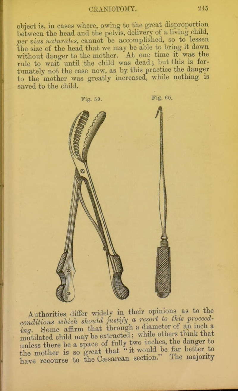 object is, in cases where, owing to tlie gi-eat disproportion between tlie head and the pelvis, dehvery of a living child, per vias naturales, cannot be accomplished, so to lessen the size of the head that we may be able to bring it down without danger to the mother. At one time it was the rule to wait until the child was dead; but this is for- tunately not the case now, as by this practice the danger to the mother was greatly increased, while nothmg is saved to the child. Fig. Fig. 60. /I Authorities differ widely in their opmious as to the conclitions ivMrh should justify a resort to this proceed- ing. Some affirm that through a diameter of a^ inch a mutilated child may be extracted; while others thmk that unless there be a space of fully two inches, the danger to the mother is so great that  it would be far better to have recourse to the OiBsarean section. The majority