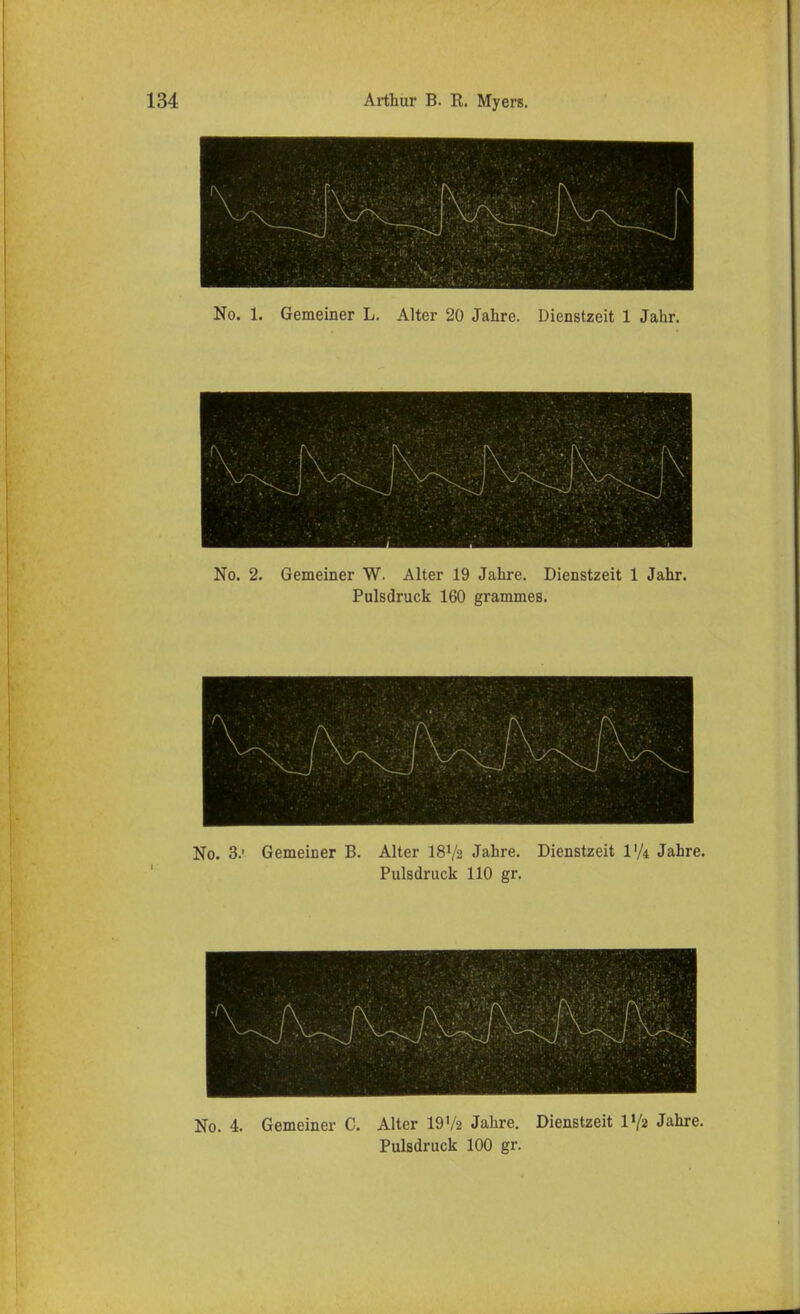 (gfll • No. 1. Gemeiner L. Alter 20 Jahre. Dienstzeit 1 Jahr. No. 2. Gemeiner W. Alter 19 Jahre. Dienstzeit 1 Jahr. Pulsdruck 160 grammes. No. 3. Gemeiner B. Alter I8V2 Jahre. Dienstzeit V/i Jahre. Pulsdruck 110 gr. No. 4. Gemeiner C. Alter 19V2 Jahre. Dienstzeit V/2 Jahre.