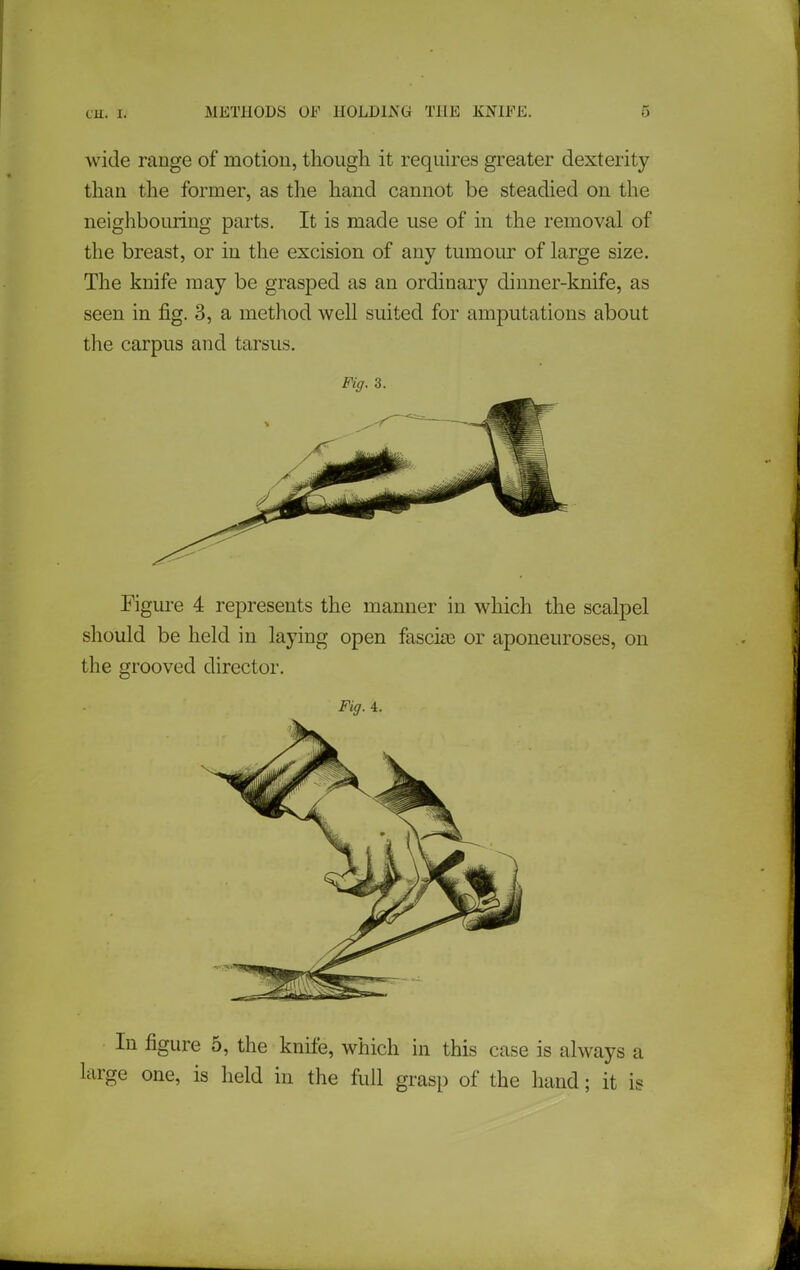 wide range of motion, though it requires greater dexterity than the former, as the hand cannot be steadied on the neighbouring parts. It is made use of in the removal of the breast, or in the excision of any tumour of large size. The knife may be grasped as an ordinary dinner-knife, as seen in fig. 3, a method well suited for amputations about the carpus and tarsus. Fiff. 3. Figure 4 represents the manner in which the scalpel should be held in laying open fascio3 or aponeuroses, on the grooved director. Fig. 4. In figure 5, the knife, which in this case is always a arge one, is held in the full grasp of the hand; it is