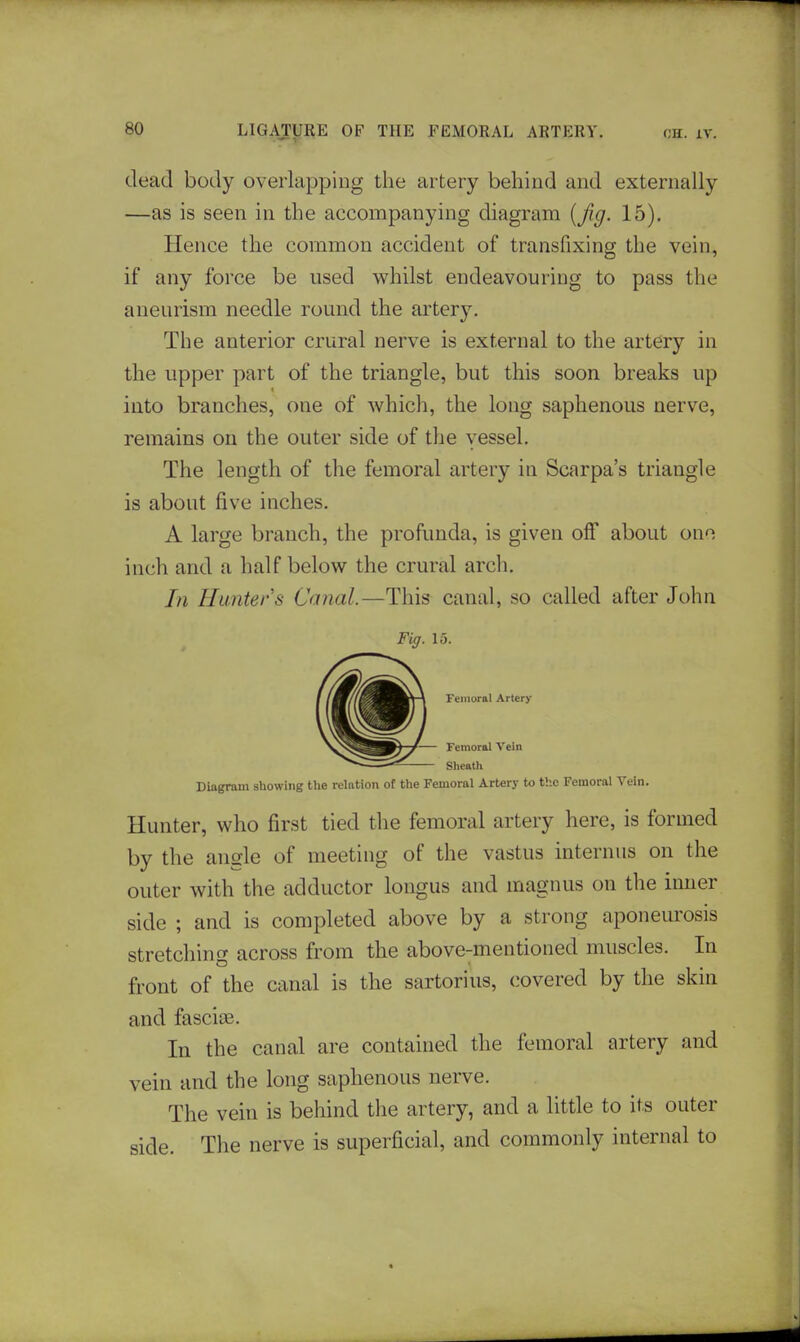 dead body overlapping the artery behind and externally —as is seen in the accompanying diagram {jig. 15). Hence the common accident of transfixing the vein, if any force be used whilst endeavouring to pass the aneurism needle round the artery. The anterior crural nerve is external to the artery in the upper part of the triangle, but this soon breaks up into branches, one of which, the long saphenous nerve, remains on the outer side of the yessel. The length of the femoral artery in Scarpa's triangle is about five inches. A large branch, the profunda, is given off about ono inch and a half below the crural arch. In Hunters Canal.—This canal, so called after John Diagram showing the relation of the Femoral Artery to the Femoral Vein. Hunter, who first tied the femoral artery here, is formed by the angle of meeting of the vastus internus on the outer with the adductor longus and magnus on the inner side ; and is completed above by a strong aponeurosis stretching across from the above-mentioned muscles. In front of the canal is the sartorius, covered by the skin and fasciee. In the canal are contained the femoral artery and vein and the long saphenous nerve. The vein is behind the artery, and a little to its outer side. The nerve is superficial, and commonly internal to