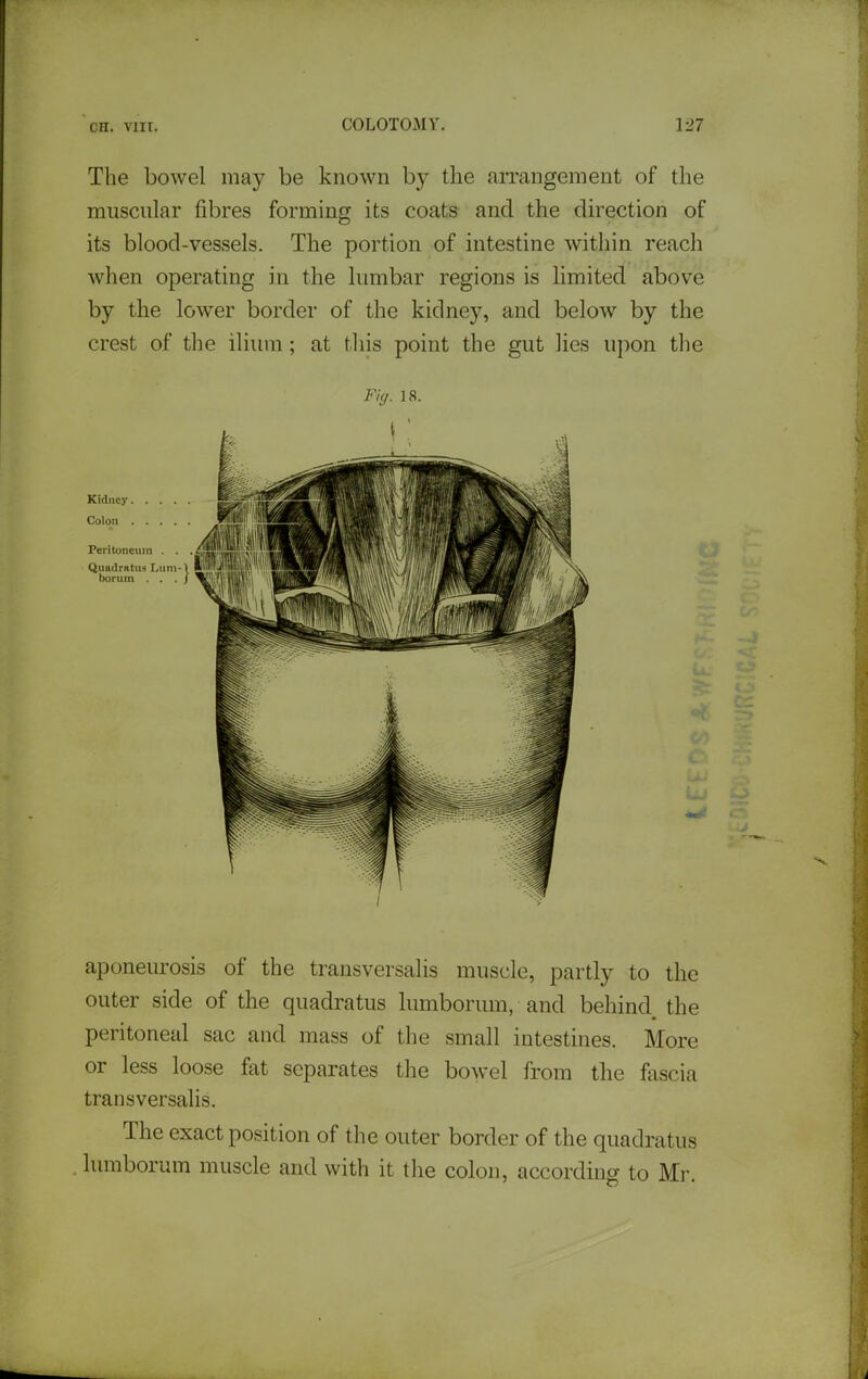 The bowel may be known by the arrangement of the muscular fibres forming its coats and the direction of its blood-vessels. The portion of intestine within reach when operating in the lumbar regions is limited above by the lower border of the kidney, and below by the crest of the ilium ; at this point the gut lies uj)on the Fig. 18. Kidney.... Colon Wei Peritoneum . . '«'  i QuadrattH I,uni-\ lil bornm . . . / *' I ijl aponeurosis of the transversalis muscle, partly to the outer side of the quadratus lumborum, and behind the peritoneal sac and mass of the small intestines. More or less loose fat separates the bowel from the fascia transversalis. The exact position of the outer border of the quadratus lumborum muscle and with it the colon, according to Mr.