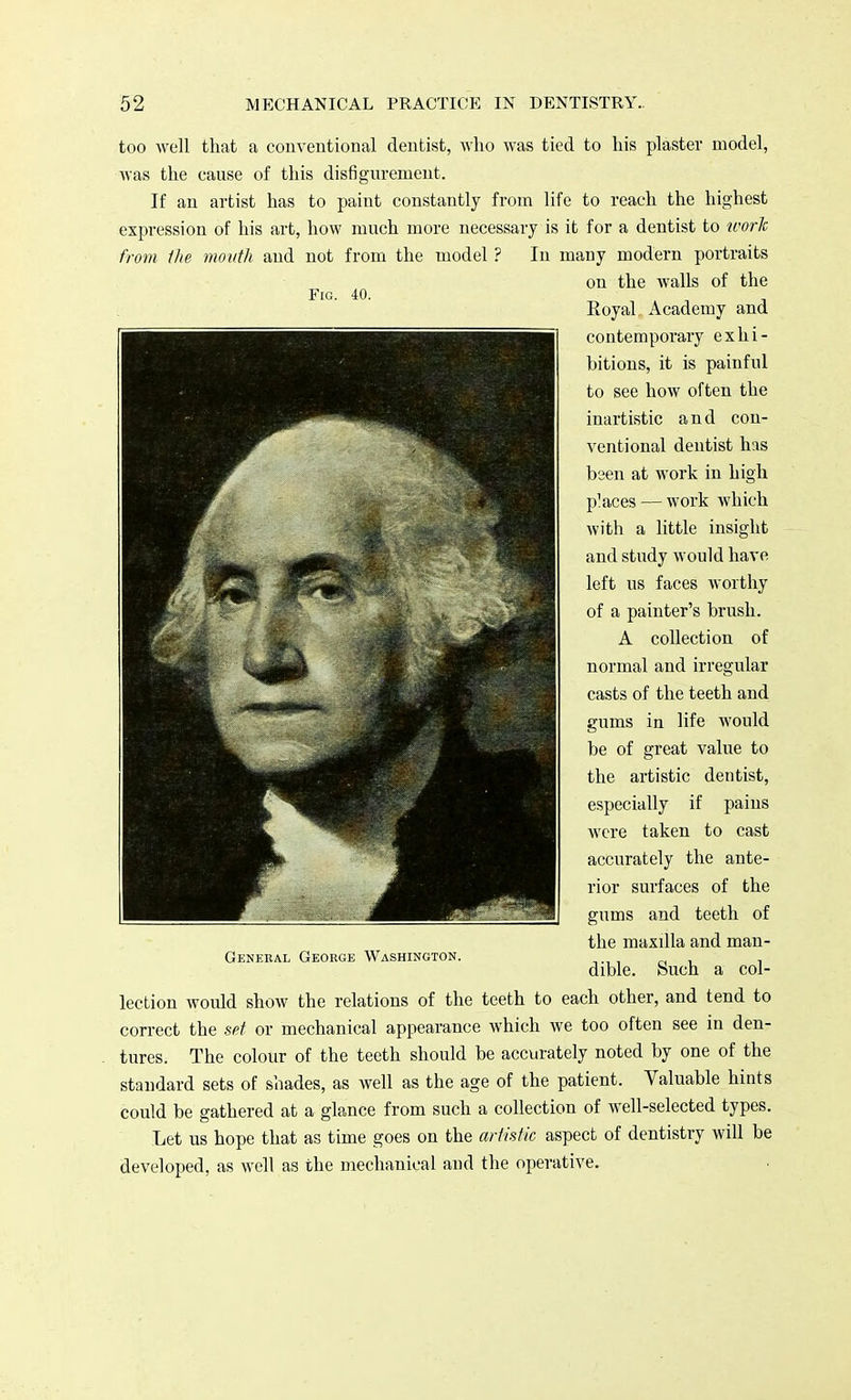 Fig. 40. too well that a conventional dentist, who was tied to his plaster model, was the cause of this disfigurement. If an artist has to paint constantly from life to reach the highest expression of his art, how much more necessary is it for a dentist to work from the mouth and not from the model ? In many modern portraits on the walls of the Royal Academy and contemporary exhi- bitions, it is painful to see how often the inartistic and con- ventional dentist has been at work in high places — work which with a little insight and study would have left us faces worthy of a painter's brush. A collection of normal and irregular casts of the teeth and gums in life would be of great value to the artistic dentist, especially if pains were taken to cast accurately the ante- rior surfaces of the gums and teeth of the maxilla and man- dible. Such a col- Ceneral George Washington. lection would show the relations of the teeth to each other, and tend to correct the set or mechanical appearance which we too often see in den- tures. The colour of the teeth should be accurately noted by one of the standard sets of shades, as well as the age of the patient. Valuable hints could be gathered at a glance from such a collection of well-selected types. Let us hope that as time goes on the artistic aspect of dentistry will be developed, as well as the mechanical aud the operative.