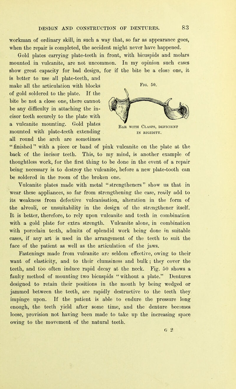 workman of ordinary skill, in such a way that, so far as appearance goes, when the repair is completed, the accident might never have happened. Gold plates carrying plate-teeth in front, with bicuspids and molars mounted in vulcanite, are not uncommon. In my opinion such cases show great capacity for bad design, for if the bite be a close one, it is better to use all plate-teeth, and make all the articulation with blocks FlG- 50- of gold soldered to the plate. If the bite be not a close one, there cannot be any difficulty in attaching the in- cisor teeth securely to the plate with a vulcanite mounting. Gold plates „ w „ ~ „„„ „„„,„,,„, ° ? jjar with Clasps, deficient mounted with plate-teeth extending IN rigidity. all round the arch are sometimes  finished with a piece or band of pink vulcanite on the plate at the back of the incisor teeth. This, to my mind, is another example of thoughtless work, for the first thing to be done in the event of a repair being necessary is to destroy the vulcanite, before a new plate-tooth can be soldered in the room of the broken one. Vulcanite plates made with metal  strengthened show us that in wear these appliances, so far from strengthening the case, ready add to its weakness from defective vulcanisation, alteration in the form of the alveoli, or unsuitability in the design of the strengthener itself. It is better, therefore, to rely upon vulcanite and teeth in combination with a gold plate for extra strength. Vulcanite alone, in combination with porcelain teeth, admits of splendid work being done in suitable cases, if any art is used in the arrangement of the teeth to suit the face of the patient as well as the articulation of the jaws. Fastenings made from vulcanite are seldom effective, owing to their want of elasticity, and to their clumsiness and bulk ; they cover the teeth, and too often induce rapid decay at the neck. Fig. 50 shows a faulty method of mounting two bicuspids  without a plate. Dentures designed to retain their positions in the mouth by being wedged or jammed between the teeth, are rapidly destructive to the teeth they impinge upon. If the patient is able to endure the pressure long enough, the teeth yield after some time, and the denture becomes loose, provision not having been made to take up the increasing space owing to the movement of the natural teeth. G 2