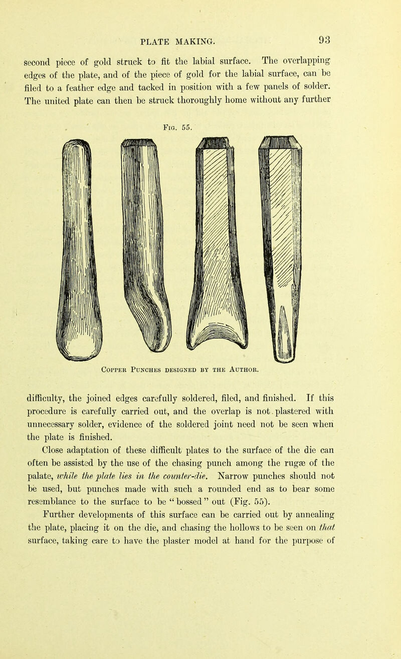 second piece of gold struck to fit the labial surface. The overlapping edges of the plate, and of the piece of gold for the labial surface, can be filed to a feather edge and tacked in position with a few panels of solder. The united plate can then be struck thoroughly home without any further Fig. 55. Copper Punches designed by the Author. difficulty, the joined edges carefully soldered, filed, and finished. If this procedure is carefully carried out, and the overlap is not. plastered with unnecessary solder, evidence of the soldered joint need not be seen when the plate is finished. Close adaptation of these difficult plates to the surface of the die can often be assisted by the use of the chasing punch among the rugae of the palate, while the plate lies in the counter-die. Narrow punches should not be used, but punches made with such a rounded end as to bear some resemblance to the surface to be bossed out (Fig. 55). Further developments of this surface can be carried out by annealing the plate, placing it on the die, and chasing the hollows to be seen on that surface, taking care to have the plaster model at hand for the purpose of