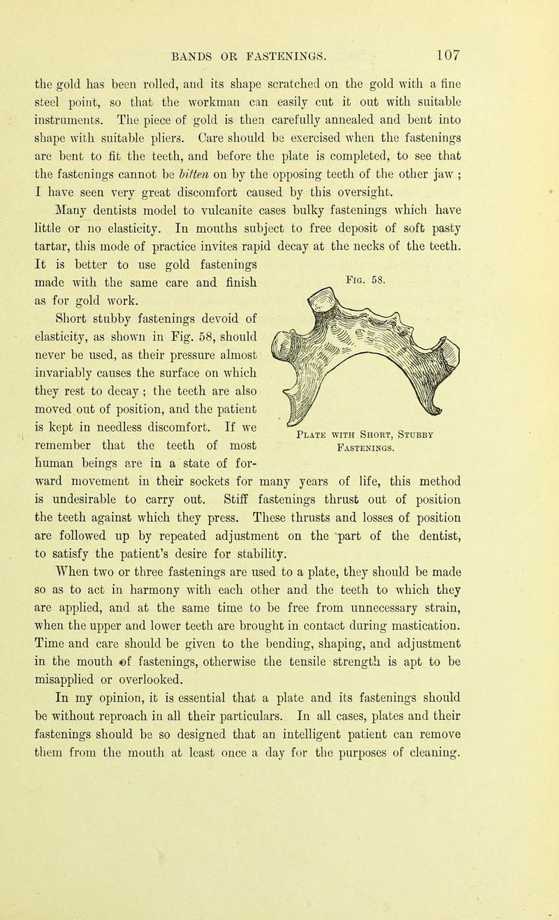 the gold has been rolled, and its shape scratched on the gold with a fine steel point, so that the workman can easily cut it out with suitable instruments. The piece of gold is then carefully annealed and bent into shape with suitable pliers. Care should be exercised when the fastenings are bent to fit the teeth, and before the plate is completed, to see that the fastenings cannot be bitten on by the opposing teeth of the other jaw ; I have seen very great discomfort caused by this oversight. Many dentists model to vulcanite cases bulky fastenings which have little or no elasticity. In mouths subject to free deposit of soft pasty tartar, this mode of practice invites rapid decay at the necks of the teeth. It is better to use gold fastenings made with the same care and finish as for gold work. Short stubby fastenings devoid of elasticity, as shown in Fig. 58, should never be used, as their pressure almost invariably causes the surface on which they rest to decay; the teeth are also moved out of position, and the patient is kept in needless discomfort. If we remember that the teeth of most human beings are in a state of for- ward movement in their sockets for many years of life, this method is undesirable to carry out. Stiff fastenings thrust out of position the teeth against which they press. These thrusts and losses of position are followed up by repeated adjustment on the part of the dentist, to satisfy the patient's desire for stability. When two or three fastenings are used to a plate, they should be made so as to act in harmony with each other and the teeth to which they are applied, and at the same time to be free from unnecessary strain, when the upper and lower teeth are brought in contact during mastication. Time and care should be given to the bending, shaping, and adjustment in the mouth of fastenings, otherwise the tensile strength is apt to be misapplied or overlooked. In my opinion, it is essential that a plate and its fastenings should be without reproach in all their particulars. In all cases, plates and their fastenings should be so designed that an intelligent patient can remove them from the mouth at least once a day for the purposes of cleaning. Fig. 58. Plate with Short, Stobby Fastenings.