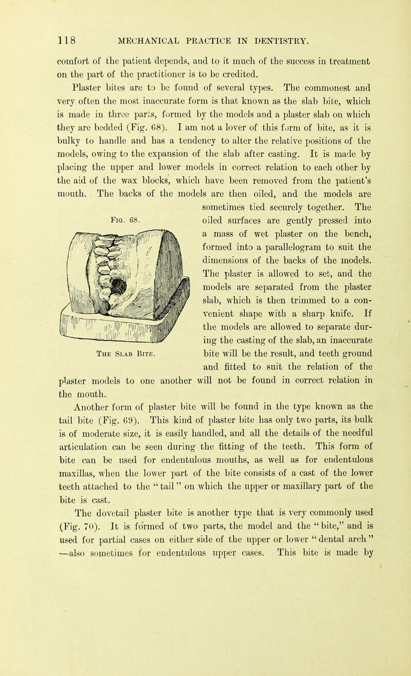 comfort of the patient depends, and to it much of the success in treatment on the part of the practitioner is to be credited. Plaster bites are to be found of several types. The commonest and very often the most inaccurate form is that known as the slab bite, which is made in three parts, formed by the models and a plaster slab on which they are bedded (Fig. 68). I am not a lover of this form of bite, as it is bulky to handle and has a tendency to alter the relative positions of the models, owing to the expansion of the slab after casting. It is made by placing the upper and lower models in correct relation to each other by the aid of the wax blocks, which have been removed from the patient's mouth. The backs of the models are then oiled, and- the models are sometimes tied securely together. The plaster models to one another will not be found in correct relation in the mouth. Another form of plaster bite will be found in the type known as the tail bite (Fig. 69). This kind of plaster bite has only two parts, its bulk is of moderate size, it is easily handled, and all the details of the needful articulation can be seen during the fitting of the teeth. This form of bite can be used for endentulous mouths, as well as for endentulous inaxillas, when the lower part of the bite consists of a cast of the lower teeth attached to the  tail on which the upper or maxillary part of the bite is cast. The dovetail plaster bite is another type that is very commonly used (Fig. 70). It is formed of two parts, the model and the  bite, and is used for partial cases on either side of the upper or lower  dental arch  —also sometimes for endentulous upper cases. This bite is made by The Slab Bite. Fig. 68. oiled surfaces are gently pressed into a mass of wet plaster on the bench, formed into a parallelogram to suit the dimensions of the backs of the models. The plaster is allowed to set, and the models are separated from the plaster slab, which is then trimmed to a con- venient shape with a sharp knife. If the models are allowed to separate dur- ing the casting of the slab, an inaccurate bite will be the result, and teeth ground and fitted to suit the relation of the