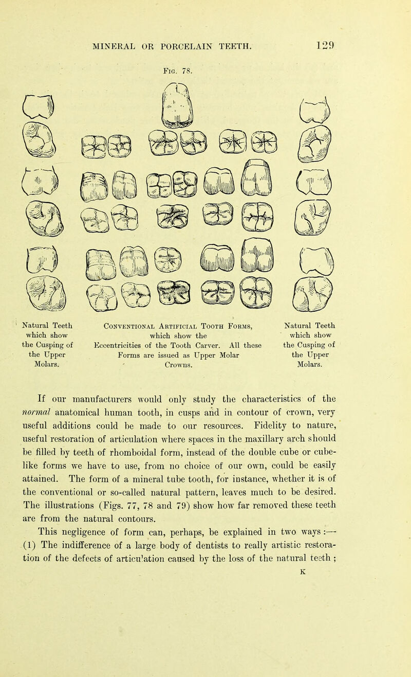 Fig. 78. Natural Teeth Conventional Artificial Tooth Forms, Natural Teeth which show which show the which show the Cusping of Eccentricities of the Tooth Carver. All these the Cusping of the Upper Forms are issued as Upper Molar the Upper Molars. Crowns. Molars. If our manufacturers would only study the characteristics of the normal anatomical human tooth, in cusps and in contour of crown, very useful additions could be made to our resources. Fidelity to nature, useful restoration of articulation where spaces in the maxillary arch should be filled by teeth of rhomboidal form, instead of the double cube or cube- like forms we have to use, from no choice of our own, could be easily attained. The form of a mineral tube tooth, for instance, whether it is of the conventional or so-called natural pattern, leaves much to be desired. The illustrations (Figs. 77, 78 and 79) show how far removed these teeth are from the natural contours. This negligence of form can, perhaps, be explained in two ways:— (1) The indifference of a large body of dentists to really artistic restora- tion of the defects of articulation caused by the loss of the natural teeth ; K