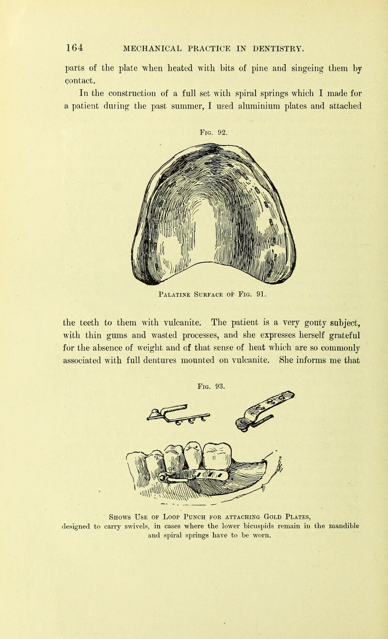 parts of the plate when heated with bits of pine and singeing them by contact. In the construction of a full set with spiral springs which I made for a patient during the past summer, I used aluminium plates and attached Fig. 92. Palatine Surface of Fig. 91. the teeth to them with vulcanite. The patient is a very gouty subject, with thin gums and wasted processes, and she expresses herself grateful for the absence of weight and of that sense of heat which are so commonly associated with full dentures mounted on vulcanite. She informs me that Fig. 93. Shows Use of Loop Punch foe attaching Gold Plates, designed to carry swivels, in cases where the lower bicuspids remain in the mandible and spiral springs have to be worn.