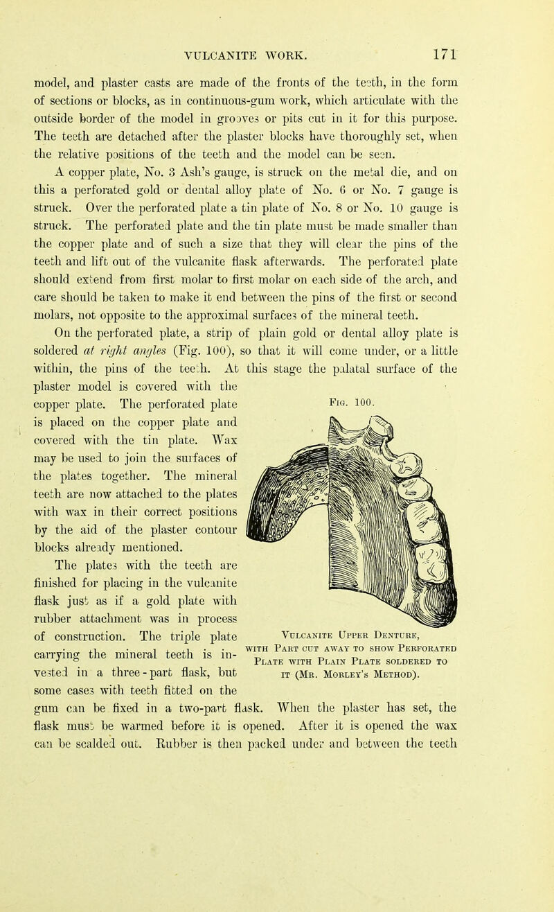 model, and plaster casts are made of the fronts of the te3th, in the form of sections or blocks, as in continuous-gum work, which articulate with the outside border of the model in grooves or pits cut in it for this purpose. The teeth are detached after the plaster blocks have thoroughly set, when the relative positions of the teeth and the model can be seen. A copper plate, No. 3 Ash's gauge, is struck on the metal die, and on this a perforated gold or dental alloy plate of No. G or No. 7 gauge is struck. Over the perforated plate a tin plate of No. 8 or No. 10 gauge is struck. The perforated plate and the tin plate must be made smaller than the copper plate and of such a size that they will clear the pins of the teeth and lift out of the vulcanite flask afterwards. The perforated plate should extend from first molar to first molar on each side of the arch, and care should be taken to make it end between the pins of the first or second molars, not opposite to the approximal surface? of the mineral teeth. On the perforated plate, a strip of plain gold or dental alloy plate is soldered at right angles (Fig. 100), so that it will come under, or a little within, the pins of the teeth. At this stage the palatal surface of the plaster model is covered with the copper plate. The perforated plate FlG- 100 ■ is placed on the copper plate and covered with the tin plate. Wax may be used to join the surfaces of the plates together. The mineral teeth are now attached to the plates with wax in their correct positions by the aid of the plaster contour blocks already mentioned. The plates with the teeth are finished for placing in the vulcanite flask just as if a gold plate with rubber attachment was in process of construction. The triple plate carrying the mineral teeth is in- vested in a three-part flask, but some cases with teeth fitted on the gum can be fixed in a two-part flask. When the plaster has set, the flask must be warmed before it is opened. After it is opened the wax can be scalded out. Rubber is then packed under and between the teeth Vulcanite Upper Denture, with Part cut away to show Perforated Plate with Plain Plate soldered to it (Mr. Morley's Method).