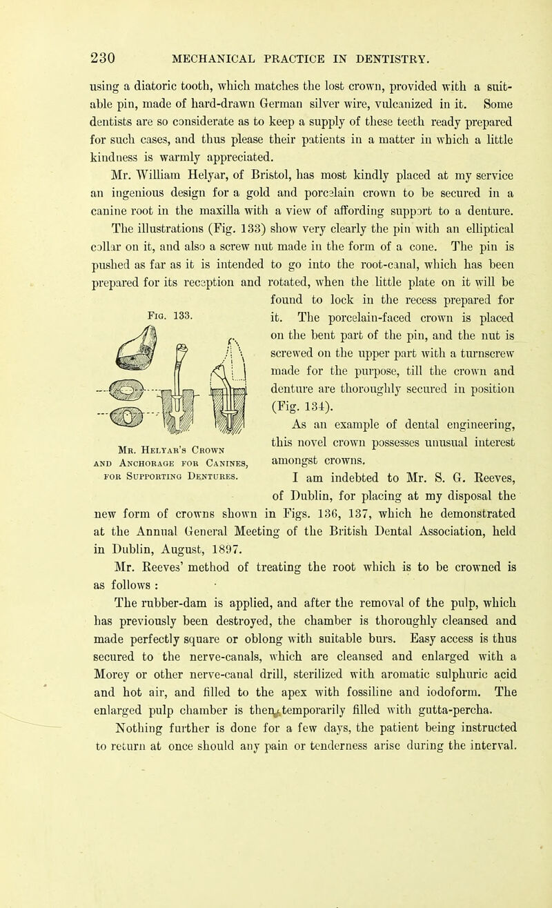 Fig. 133. using a diatoric tooth, which matches the lost crown, provided with a suit- able pin, made of hard-drawn German silver wire, vulcanized in it. Some dentists are so considerate as to keep a supply of these teeth ready prepared for such cases, and thus please their patients in a matter in which a little kindness is warmly appreciated. Mr. William Helyar, of Bristol, has most kindly placed at my service an ingenious design for a gold and porcalain crown to be secured in a canine root in the maxilla with a view of affording support to a denture. The illustrations (Fig. 133) show very clearly the pin with an elliptical collar on it, and also a screw nut made in the form of a cone. The pin is pushed as far as it is intended to go into the root-canal, which has been prepared for its recsption and rotated, when the little plate on it will be found to lock in the recess prepared for it. The porcelain-faced crown is placed on the bent part of the pin, and the nut is screwed on the upper part with a turnscrew made for the purpose, till the crown and denture are thoroughly secured in position (Fig. 134). As an example of dental engineering, this novel crown possesses unusual interest amongst crowns. I am indebted to Mr. S. G. Reeves, of Dublin, for placing at my disposal the new form of crowns shown in Figs. 136, 137, which he demonstrated at the Annual General Meeting of the British Dental Association, held in Dublin, August, 1897. Mr. Reeves' method of treating the root which is to be crowned is as follows : The rubber-dam is applied, and after the removal of the pulp, which has previously been destroyed, the chamber is thoroughly cleansed and made perfectly square or oblong with suitable burs. Easy access is thus secured to the nerve-canals, which are cleansed and enlarged with a Morey or other nerve-canal drill, sterilized with aromatic sulphuric acid and hot air, and filled to the apex with fossiline and iodoform. The enlarged pulp chamber is then* temporarily filled with gutta-percha. Nothing further is done for a few days, the patient being instructed to return at once should any pain or tenderness arise during the interval. Mr. Heltar's Crown and Anchorage for Canines, tor Supporting Dentures.