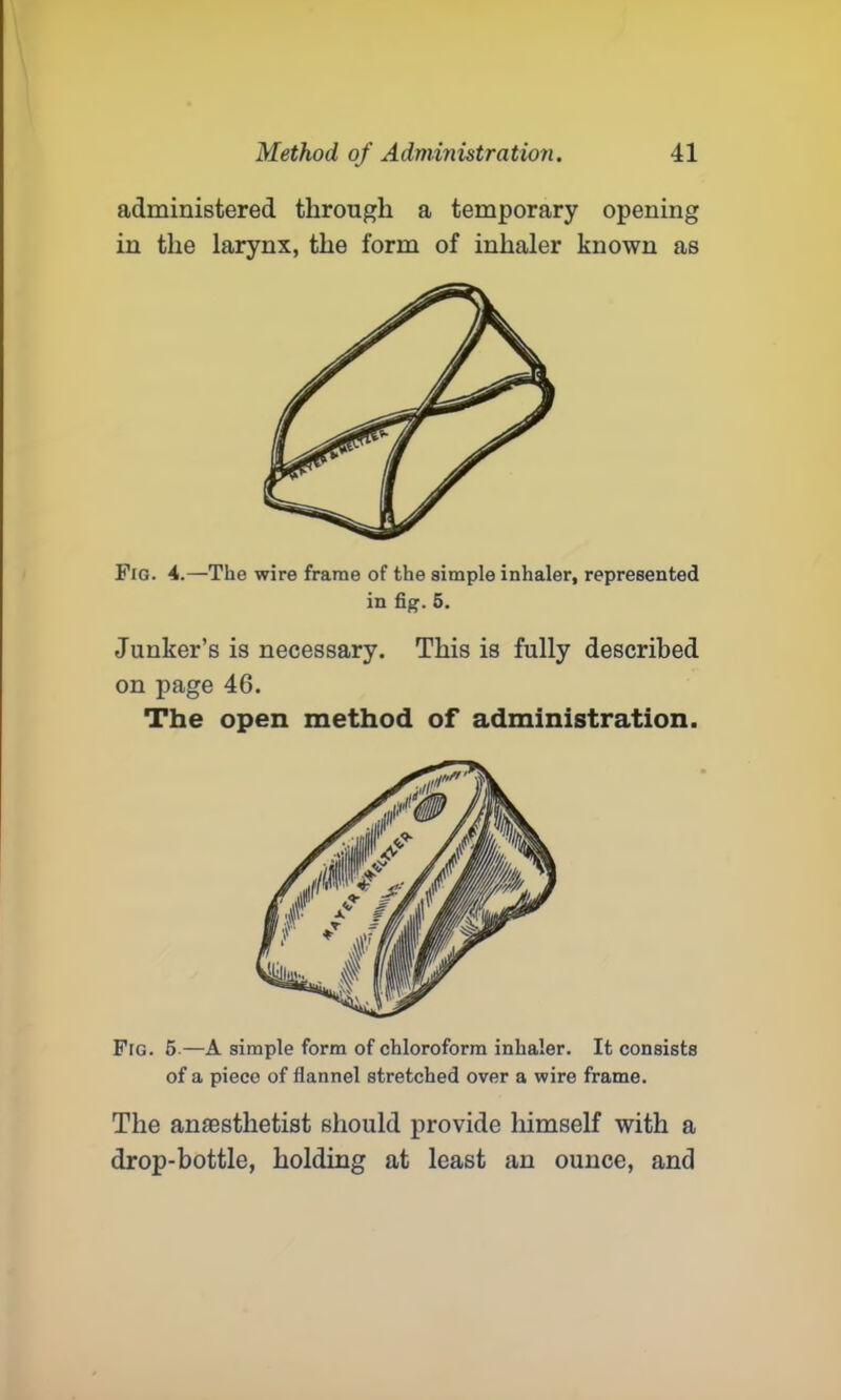administered through a temporary opening in the larynx, the form of inhaler known as Fig. 4.—The wire frame of the simple inhaler, represented in fig. 5. Junker’s is necessary. This is fully described on page 46. The open method of administration. Fig. 5.—A simple form of chloroform inhaler. It consists of a piece of flannel stretched over a wire frame. The antestlietist should provide himself with a drop-bottle, holding at least an ounce, and