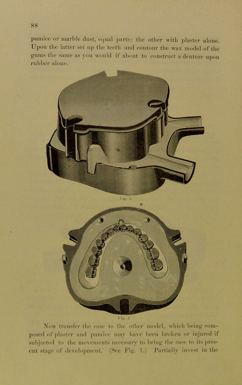 pumice or marble dust, equal parts; the other with plaster alone. Upon the latter set up the teeth and contour the wax model of the gums the same as you would if about to construct a denture upon rubber alone. Now transfer the case to the. other model, which being com- posed of plaster and pumice may have been broken or injured it subjected to the movements necessary to bring the case to its pres- ent stage of development. (See Fig. 1.) Partially invest in the