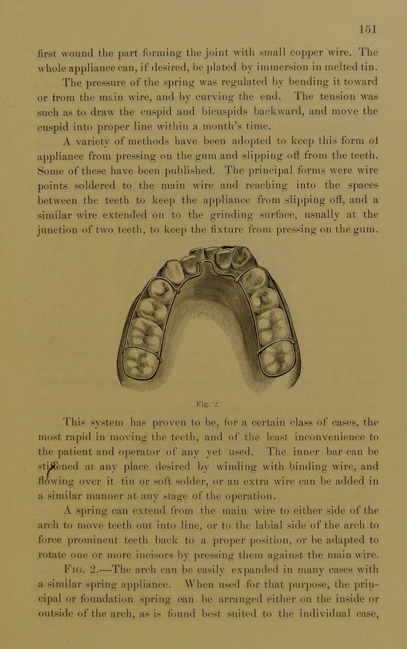 first wound the part forming the joint with small copper wire. The whole appliance can, if desired, be plated by immersion in melted tin. The pressure of the spring was regulated bv bending it toward or from the main wire, and by curving the end. The tension was such as to draw the cuspid and bicuspids backward, and move the cuspid into proper line within a month’s time. A variety of methods have been adopted to keep this form of appliance from pressing on the gum and slipping off from the teeth. Some of these have been published. The principal forms were wire points soldered to the main wire and reaching into the spaces between the teeth to keep the appliance from slipping off, and a similar wire extended on to the grinding surface, usually at the junction of two teeth, to keep the fixture from pressing on the gum. Fig. 2. This system has proven to be, for a certain class of cases, the most rapid in moving the teeth, and of the least inconvenience to the patient and operator of any yet used. The inner bar can be stiffened at any place desired by winding with binding wire, and flowing over it tin or soft solder, or an extra wire can be added in a similar manner at any stage of the operation. A spring can extend from the main wire to either side of the arch to move teeth out into line, or to the labial side of the arch to force prominent teeth back to a proper position, or be adapted to rotate one or more incisors by pressing them against the main wire. Fig. 2.—The arch can be easily expanded in many cases with a similar spring appliance. When used for that purpose, the prin- cipal or foundation spring can be arranged cither on the inside or outside of the arch, as is found best suited to the individual case,