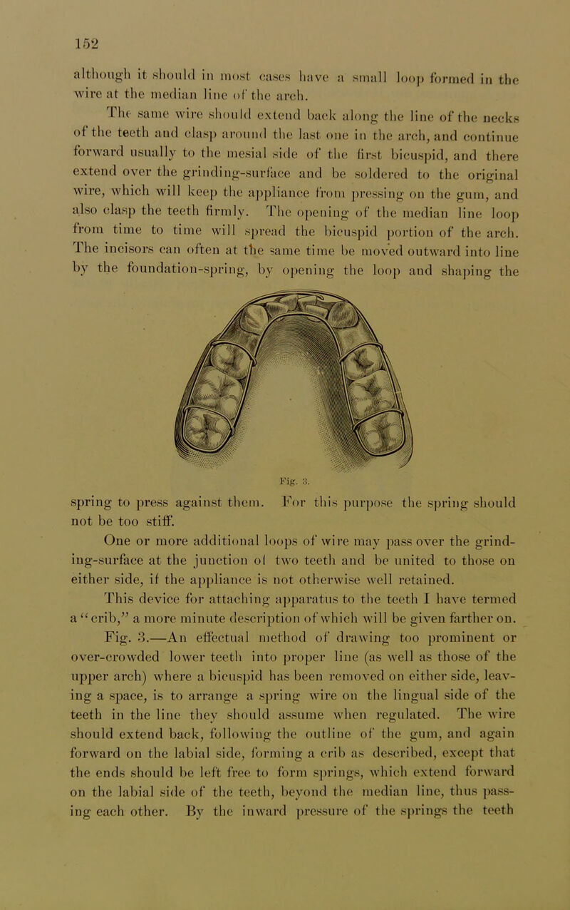 although it should in most cases have a small loop formed in the wire at the median line of the arch. 1 lu same wire should extend back along the line of the necks of the teeth and clasp around the last one m the arch, and continue forward usually to the mesial side of the first bicuspid, and there extend over the grinding-surface and be soldered to the original wire, which will keep the appliance from pressing on the gum, and also clasp the teeth firmly. The opening of the median line loop from time to time will spread the bicuspid portion of the arch. The incisors can often at the same time be moved outward into line by the foundation-spring, by opening the loop and shaping the Fig. 3. spring to press against them. For this purpose the spring should not be too stiff. One or more additional loops of wire may pass over the grind- ing-surface at the junction ol two teeth and be united to those on either side, if the appliance is not otherwise well retained. This device for attaching apparatus to the teeth I have termed a “crib,” a more minute description of which will be given farther on. Fig. 3.—An effectual method of drawing too prominent or over-crowded lower teeth into proper line (as well as those of the upper arch) where a bicuspid has been removed on either side, leav- ing a space, is to arrange a spring wire on the lingual side of the teeth in the line they should assume when regulated. The wire should extend back, following the outline of the gum, and again forward on the labial side, forming a crib as described, except that the ends should be left free to form springs, which extend forward on the labial side of the teeth, beyond the median line, thus pass- ing each other. By the inward pressure of the springs the teeth