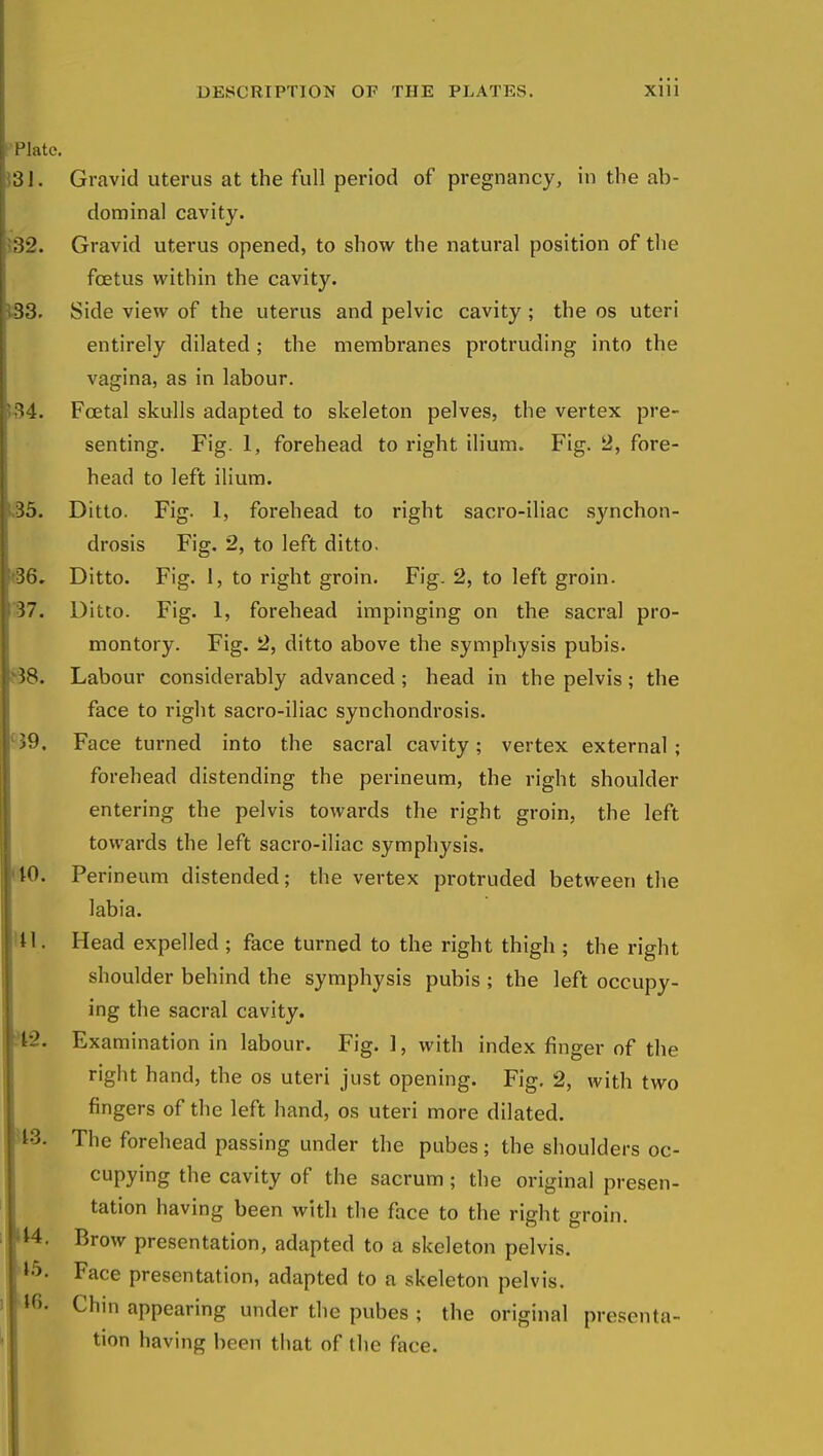 Plate. 31. Gravid uterus at the full period of pregnancy, in the ab- dominal cavity. 32. Gravid uterus opened, to show the natural position of the foetus within the cavity. 33. Side view of the uterus and pelvic cavity ; the os uteri entirely dilated; the membranes protruding into the vagina, as in labour. 34. Foetal skulls adapted to skeleton pelves, the vertex pre- senting. Fig. 1, forehead to right ilium. Fig. 2, fore- head to left ilium. Ditto. Fig. 1, forehead to right sacro-iliac synchon- drosis Fig. 2, to left ditto. Ditto. Fig. 1, to right groin. Fig. 2, to left groin. Ditto. Fig. 1, forehead impinging on the sacral pro- montory. Fig. 2, ditto above the symphysis pubis. Labour considerably advanced; head in the pelvis; the face to right sacro-iliac synchondrosis. Face turned into the sacral cavity; vertex external; forehead distending the perineum, the right shoulder entering the pelvis towards the right groin, the left towards the left sacro-iliac symphysis. Perineum distended; the vertex protruded between the labia. Head expelled ; face turned to the right thigh ; the right shoulder behind the symphysis pubis ; the left occupy- ing the sacral cavity. Examination in labour. Fig. 1, with index finger of the right hand, the os uteri just opening. Fig. 2, with two fingers of the left hand, os uteri more dilated. 13. The forehead passing under the pubes ; the shoulders oc- cupying the cavity of the sacrum; the original presen- tation having been with the face to the right groin. Brow presentation, adapted to a skeleton pelvis. Face presentation, adapted to a skeleton pelvis. Chin appearing under the pubes ; the original presenta- tion having been that of the face.