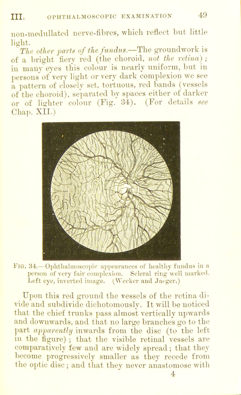 uon-meclullated nerve-fibres, which reflect but little lio-ht. ^The other parts of the fundus.—The gTOunclwork is of a bright fiery red (the choroid, not the retina); iu uiauv eves this colour is nearly uniform, but in persons of'very light or very dark complexion we see a pattern of closely set, tortuous, red bands (vessels of the choroid), separated by spaces either of darker or of lighter colour (Fig. 34). (For details see Chap. XII.) Fig. 34.— Oplithiilmoscopic appearances of liealtliy fundus in a person of very fair complexion. Scleral ring well uiarkeil. Left eye, inverted image. '^Wecker and Jai^ger.) UlDon this red ground the vessels of the retina di- vide and subdivide dichotomously. It will be noticed that the chief trunks pass almost vertically upwards and downwards, and that no large branches go to the part apjjarently inwards from the disc (to the left in the figure) ; that the visible retinal vessels are comparatively few and are widely spread; that they become progressively smaller as they recede from the optic disc ; and that they never anastomose with 4