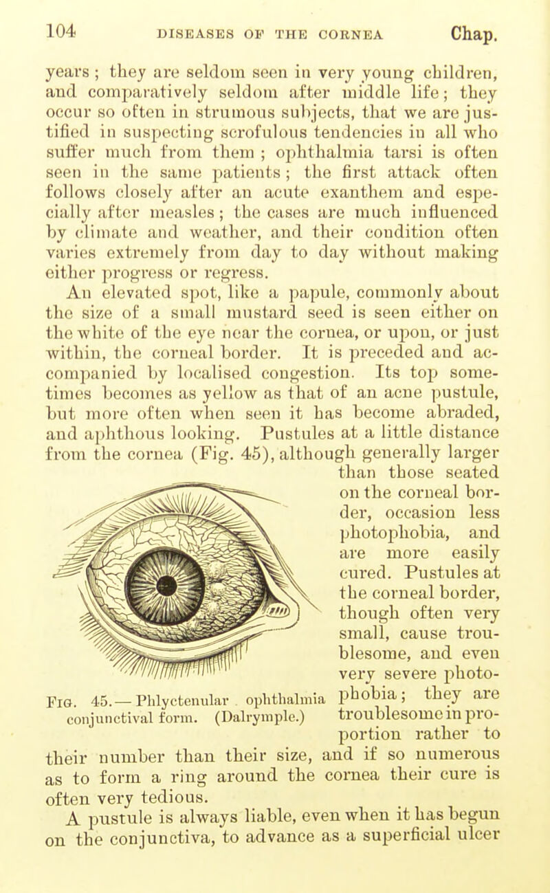 years ; they are seldom seen in very young children, and comparatively seldom after middle life; they occur so often in strumous subjects, that we are jus- tified in suspecting scrofulous tendencies in all who suffer much from them ; ophthalmia tai'si is often seen in the same jiatients ; the first attack often follows closely after an acute exanthem and espe- cially after measles ; the cases are much influenced by climate and weather, and their condition often varies extremely from day to day without making cither progress or regress. An elevated spot, like a papule, commonly about the size of a small mustard seed is seen either on thewbite of tbe eye near the cornea, or upon, or just within, tbe corneal border. It is preceded and ac- companied by localised congestion. Its top some- times becomes as yellow as that of an acne pustule, but more often when seen it has become abraded, and ajihthous looking. Pustules at a little distance from the cornea (Fig. 45), although generally larger than tbose seated on the corneal bor- der, occasion less photophobia, and are more easily cured. Pustules at tbe corneal border, though often very small, cause trou- blesome, and even very severe photo- FlG. 45.—Phlyctenular ophthalmia pbobia; they are conjunctival form. (Dalrymple.) troublesome m pro- portion rather to their number than their size, and if so numerous as to form a ring around the cornea their cure is often very tedious. A pustule is always liable, even when it has begun on the conjunctiva, to advance as a superficial ulcer