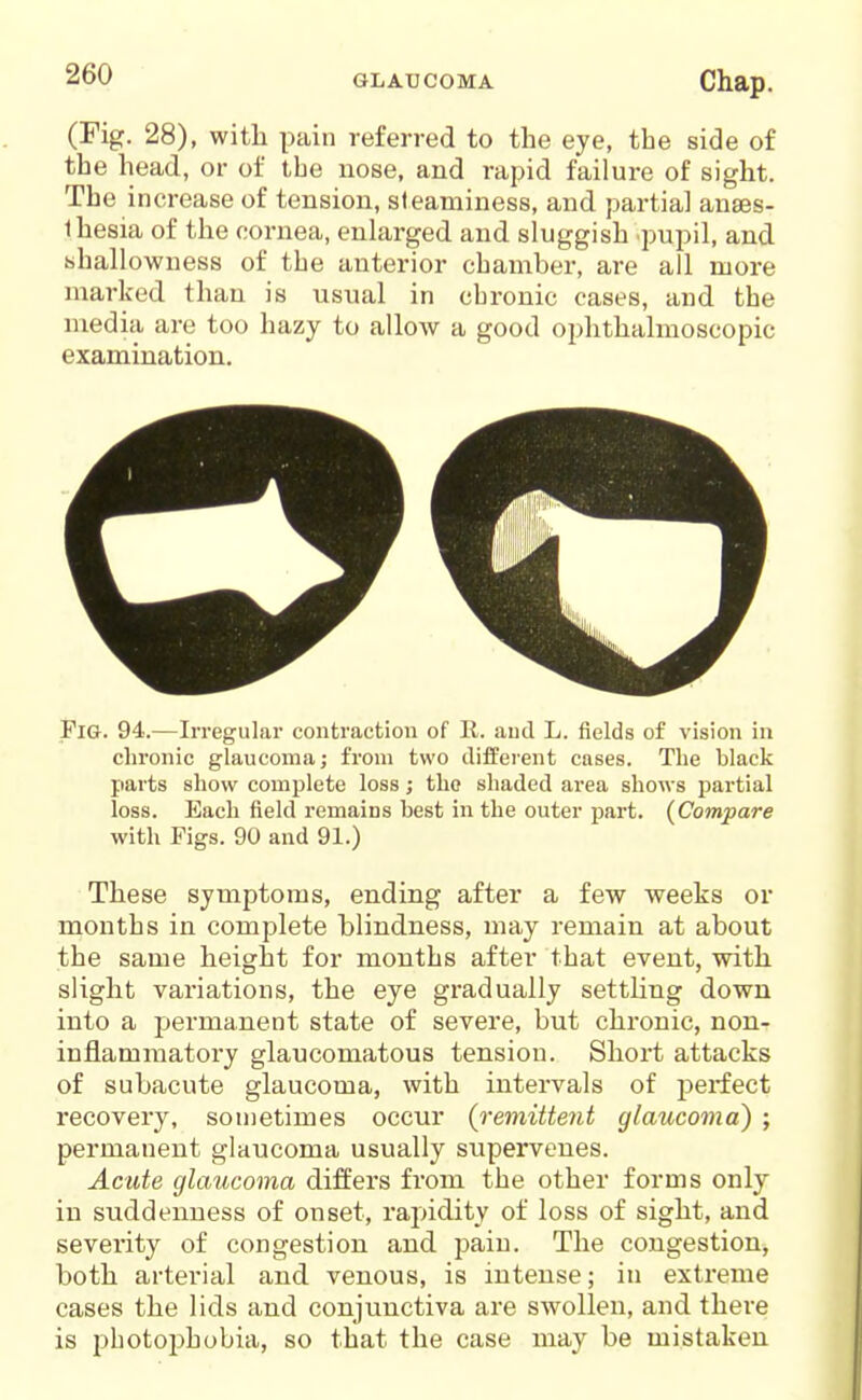 (Fig. 28), witli pain referred to the eye, the side of the head, or of tbe nose, and rapid failure of sight. The increase of tension, steaminess, and partial anses- Ihesia of the cornea, enlarged and sluggish pupil, and shallowness of tbe anterior chamber, are all more marked than is usual in chronic cases, and the media are too hazy to allow a good ophthalmoscopic examination. Fig. 94.—Irregular contraction of R. and L. fields of vision in chronic glaucoma; from two different cases. The black parts show complete loss; the shaded area shows partial loss. Each field remains best in the outer part. (Compare with Figs. 90 and 91.) These symptoms, ending after a few weeks or months in complete blindness, may remain at about the same height for months after that event, with slight variations, the eye gradually settling down into a permanent state of severe, but chronic, non- inflammatory glaucomatous tension. Short attacks of subacute glaucoma, with intervals of perfect recovery, sometimes occur {remittent glaucoma) ; permanent glaucoma usually supervenes. Acute glaucoma differs from the other forms only in suddenness of onset, rapidity of loss of sight, and severity of congestion and pain. The congestion, both arterial and venous, is intense; in extreme cases the lids and conjunctiva are swollen, and there is jibotoj^hobia, so that the case may be mistaken