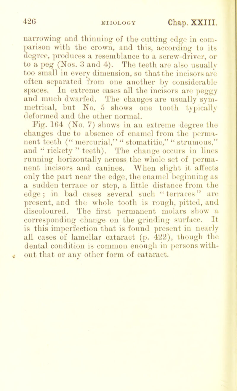 42G luiiTowing and tliinnin-^ of the cuttinj^' odgo in com- ]>arison with the crown, and this, according to its dogrce, produces a resemblance to a screw-driver, or to a ])eg (Nos. 3 and 4). The teetli an; also usually too small in every dimension, so that the incisors are often 8ei)arated from one another by considei'able spaces. In extreme cases all the incisors are i)eg'gy and much dwarfed. The changes are usually sym- metrical, but No. 5 shows one tooth typically deformed and the other normal. Fig. 1(J4 (No. 7) shows in an extreme degree tlie changes due to absence of enamel from the perma- nent tei'th ( mercurial,  stoniatitic,  strumous, and  rickety  teeth). The change occurs in lines running horizontally across the whole set of perma- nent incisors and canines. When slight it affects only the part near the edge, the enamel beginning as a sudden terrace or step, a little distance from the edge; in bad cases several such terraces are present, and the whole tooth is rough, pitted, and discoloured. The first permanent molars show a corresponding change on the grinding surface. It is this imperfection that is found present in nearly all cases of lamellar cataract (p. 422), though the dental condition is common enough in persons with- out that or any other form of cataract.