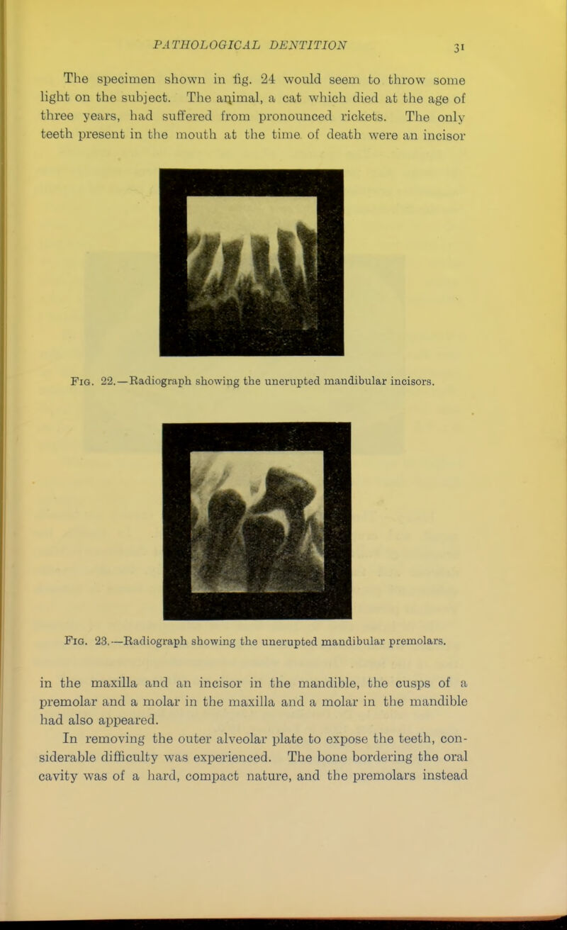 The specimen shown in iig. 24 would seem to throw some light on the suhject. The anjmal, a cat which died at the age of three years, had suffered from pronounced rickets. The only teeth present in the mouth at the time of death were an incisor Fig. 22.—Radiograph showing the unerupted mandibular incisors. Fig. 23.—Radiograph showing the unerupted mandibular premolars. in the maxilla and an incisor in the mandible, the cusps of a premolar and a molar in the maxilla and a molar in the mandible had also appeared. In removing the outer alveolar plate to expose the teeth, con- siderable difficulty was experienced. The bone bordering the oral cavity was of a hard, compact nature, and the premolars instead