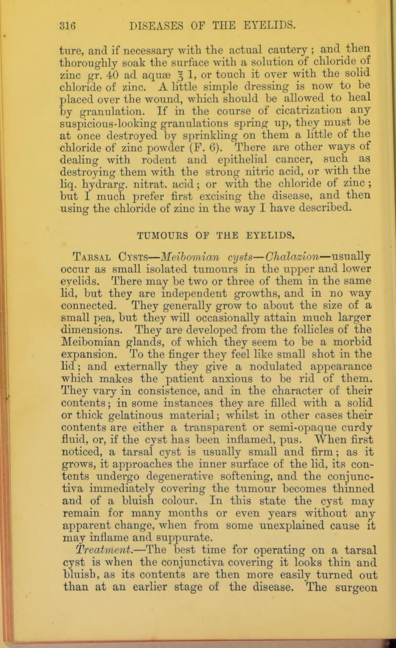 ture, and if necessary -with the actual cautery ; and tlien thoroughly soak the surface with a solution of chloride of zinc gr. 40 ad aquae 3 1, or touch it over with the solid chloride of zinc. A little simple dressing is now to be placed over the wound, which should be allowed to heal by granulation. If in the course of cicatrization any susioicious-looking granulations spring up, they must be at once destroyed by sprinkling on them a little of the chloride of zinc powder (F. 6). There are other ways of dealing with rodent and epithelial cancer, such as destroying them with the strong nitric acid, or with the liq. hydrarg. nitrat. acid; or with the chloride of zinc; but I much prefer first excising the disease, and then using the chloride of zinc in the way I have described. TUMOURS OF THE EYELIDS. Taesal Cysts—Meihomicm cysts—Chalazion—usually occur as small isolated tumours in the upper and lower evelids. There may be two or three of them in the same lid, but they are mdependent growths, and in no way connected. They generally grow to about the size of a small pea, but they will occasionally attain much larger dimensions. They are developed from the follicles of the Meibomian glands, of which they seem to be a morbid expansion. To the finger they feel like small shot in the lid; and externally they give a nodulated appearance which makes the patient anxious to be rid of them. They vary in consistence, and in the character of their contents; in some instances they are filled with a solid or thick gelatinous material; whilst in other cases their contents are either a transparent or semi-opaque curdy fluid, or, if the cyst has been inflamed, pus. When first noticed, a tarsal cyst is usually smaU and firm; as it grows, it ajoproaches the inner surface of the lid, its con- tents undergo degenei-ative softening, and the conjunc- tiva immediately covering the tumour becomes thinned and of a bluish colour. In this state the cyst may remain for many months or even years without any apparent change, when from some unexplained cause it may inflame and suppurate. Treatment.—The best time for operating on a tarsal cyst is when the conjunctiva covering it looks thin and bluish, as its contents are then more easily turned out than at au earlier stage of the disease. The surgeon