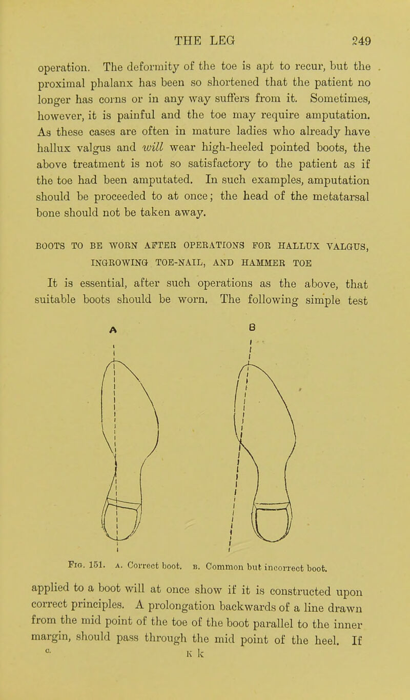 operation. The deformity of tlie toe is apt to recur, but the proximal phalanx has been so shortened that the patient no longer has corns or in any way suffers from it. Sometimes, however, it is painful and the toe may require amputation. As these cases are often in mature ladies who already have hallux valgus and will wear high-heeled pointed boots, the above treatment is not so satisfactory to the patient as if the toe had been amputated. In such examples, amputation should be proceeded to at once; the head of the metatarsal bone should not be taken away. BOOTS TO BE WORN AFTER OPERATIONS FOR HALLUX VALGUS, INGROWINQ TOE-NAIL, AND HAMMER TOE It is essential, after such operations as the above, that suitable boots should be worn. The following simple test Fio. 15L A. Correct boot. b. Common but incorrect boot. applied to a boot will at once show if it is constructed upon correct principles. A prolongation backwards of a line drawn from the mid point of the toe of the boot parallel to the inner margin, should pass through the mid point of the heel. If