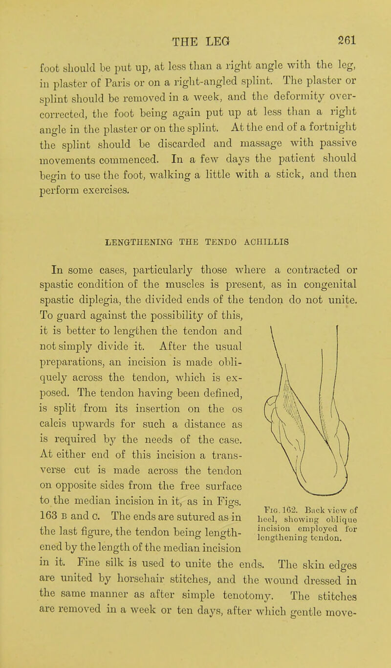 foot should be put up, at less tlian a riglit angle with the leg, in plaster of Paris or on a right-angled splint. The plaster or splint should be removed in a week, and the deformity over- corrected, the foot being again put up at less than a right angle in the plaster or on the splint. At the end of a fortnight the splint should be discarded and massage Avith passive movements commenced. In a few days the patient should begin to use the foot, walking a little with a stick, and then perform exercises. LENGTHENING THE TENDO ACHILLIS In some cases, particularly those where a contracted or spastic condition of the muscles is present, as in congenital spastic diplegia, the divided ends of the tendon do not unite. To guard against the possibility of this, it is better to lengthen the tendon and not simply divide it. After the usual preparations, an incision is made obli- quely across the tendon, which is ex- posed. The tendon having been defined, is split from its insertion on the os calcis upwards for such a distance as is required by the needs of the case. At either end of this incision a trans- verse cut is made across the tendon on opposite sides from the free surface to the median incision in it, as in Figs. 163 B and c. The ends are sutured as in the last figure, the tendon being length- ened by the length of the median incision in it. Fine silk is used to unite the ends. The skin edges are united by horsehair stitches, and the wound dressed in the same manner as after simple tenotomy. The stitches are removed in a week or ten days, after M'hich gentle move- F1G.IG2. Back view of lioel, showing oblique incision employed lor lengthening tendon.