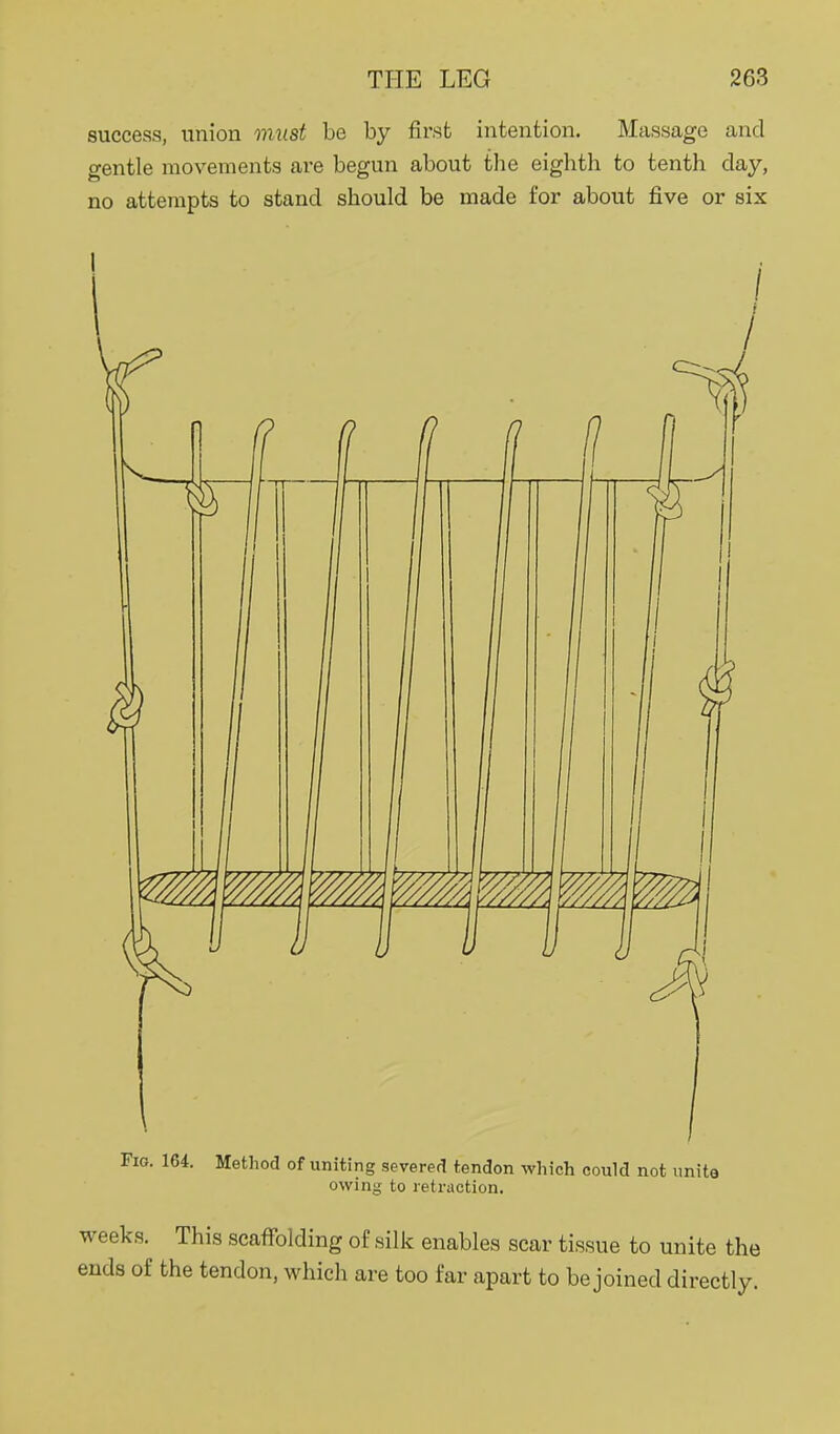 success, union onust be by first intention. Massage and gentle movements are begun about the eighth to tenth day, no attempts to stand should be made for about five or six owing to retraction. weeks. This scaffolding of silk enables scar tissue to unite the ends of the tendon, which are too far apart to be joined directly.