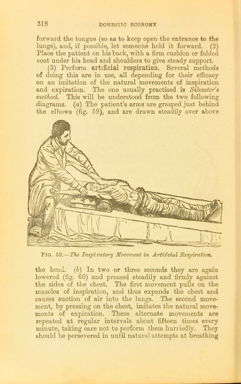 forward the tongue (so as to keep open the entrance to the lungs), and, if possible, let someone hold it forward. (2) Place the patient on his back, with a firm cushion or folded coat under his head and shoulders to give steady support. (3) Perform artificial respiration. Several methods of doing this are in use, all depending for their efficacy on an imitation of the natural movements of inspiration and expiration. The one usually practised is Silvester’s method. This will be understood from the two following diagrams, (a) The patient’s arms are grasped just behind the elbows (fig. 59), and are drawn steadily over above Fig. 69.—The Inspiratory Movement in Artificial Respiration. the head, (b) In two or three seconds they are again lowered (fig. 60) and pressed steadily and firmly against the sides of the chest. The first movement pulls on the muscles of inspiration, and thus expands the chest and causes suction of air into the lungs. The second move- ment, by pressing on the chest, imitates the natural move- ments of expiration. These alternate movements are repeated at regular intervals about fifteen times every minute, taking care not to perform them hurriedly. They should be persevered in until natural attempts at breathing