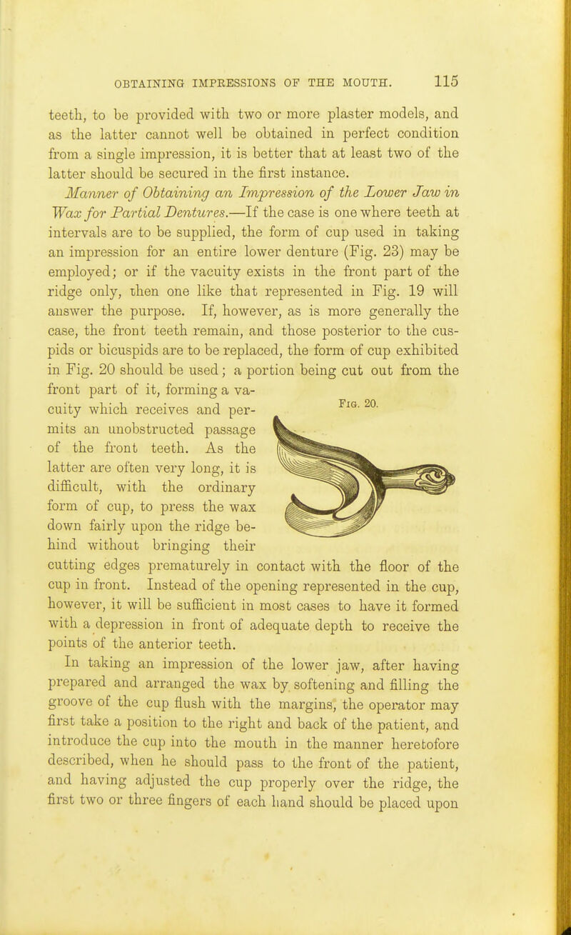 teeth, to be provided with two or more plaster models, and as the latter cannot well be obtained in perfect condition from a single impression, it is better that at least two of the latter should be secured in the first instance. Manner of Obtaining an Impression of the Lower Jaw in Wax for Partial Dentures.—If the case is one where teeth at intervals are to be supplied, the form of cup used in taking an impression for an entire lower denture (Fig. 23) may be employed; or if the vacuity exists in the front part of the ridge only, then one like that represented in Fig. 19 will answer the purpose. If, however, as is more generally the case, the front teeth remain, and those posterior to the cus- pids or bicuspids are to be replaced, the form of cup exhibited in Fig. 20 should be used; a portion being cut out from the front part of it, forming a va- cuity which receives and per- mits an unobstructed passage of the front teeth. As the latter are often very long, it is difficult, with the ordinary form of cup, to press the wax down fairly upon the ridge be- hind without bringing their cutting edges prematurely in contact with the floor of the cup in front. Instead of the opening represented in the cup, however, it will be sufficient in most cases to have it formed with a depression in front of adequate depth to receive the points of the anterior teeth. In taking an impression of the lower jaw, after having prepared and arranged the wax by softening and filling the groove of the cup flush with the margins, the operator may first take a position to the right and back of the patient, and introduce the cup into the mouth in the manner heretofore described, when he should pass to the front of the patient, and having adjusted the cup properly over the ridge, the first two or three fingers of each hand should be placed upon