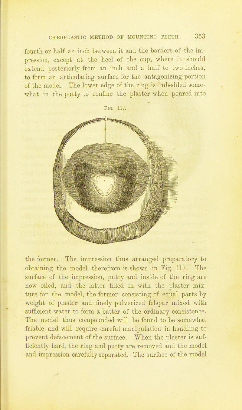 fourth or half an inch between it and the borders of the im- pression, except at the heel of the cup, where it should extend posteriorly from an inch and a half to two inches, to form an articulating surface for the antagonizing portion of the model. The lower edge of the ring is imbedded some- what in the putty to confine the plaster when poured into Fig. 117. the former. The impression thus arranged preparatory to obtaining the model therefrom is shown in Fig. 117. The surface of the impression, putty and inside of the ring are now oiled, and the latter filled in with the plaster mix- ture for the model, the former consisting of equal parts by weight of plaster and finely pulverized felspar mixed with sufficient water to form a batter of the ordinary consistence. The model thus compounded will be found to be somewhat friable and will require careful manipulation in handling to prevent defacement of the surface. When the plaster is suf- ficiently hard, the ring and putty are removed and the model and impression carefully separated. The surface of the model