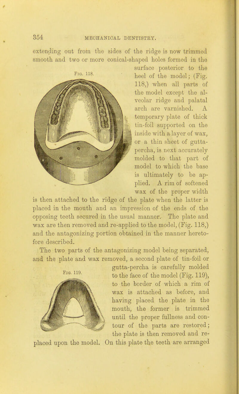 Fifi. 118. extending out from the sides of the ridge is now trimmed smooth and two or more conical-shaped holes formed in the surface posterior to the heel of the model; (Fig. 118,) when all parts of the model except the al- veolar ridge and palatal arch are varnished. A temporary plate of thick tin-foil supported on the inside with a layer of wax, or a thin sheet of gutta- percha, is next accurately molded to that part of model to which the base is ultimately to be ap- plied. A rim of softened wax of the proper width is then attached to the ridge of the plate when the latter is placed in the mouth and an impression of the ends of the opposing teeth secured in the usual manner. The plate and wax are then removed and re-applied to the model, (Fig. 118,) and the antagonizing portion obtained in the manner hereto- fore described. The two parts of the antagonizing model being separated, and the plate and wax removed, a second plate of tin-foil or gutta-percha is carefully molded to the face of the model (Fig. 119), to the border of which a rim of wax is attached as before, and having placed the plate in the mouth, the former is trimmed until the proper fullness and con- tour of the parts are restored; the plate is then removed and re- placed upon the model. On this plate the teeth are arranged Fig. 119.