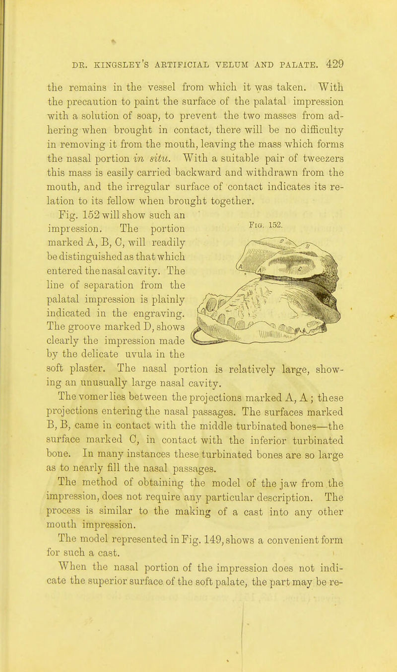 the remains in the vessel from which it was taken. With the precaution to paint the surface of the palatal impression with a solution of soap, to prevent the two masses from ad- hering when brought in contact, there will be no difl&culty in removing it from the mouth, leaving the mass which forms the nasal portion in situ. With a suitable pair of tweezers this mass is easily carried backward and withdrawn from the mouth, and the irregular surface of contact indicates its re- lation to its fellow when brought together. Fig. 152 will show such an impression. The portion marked A, B, C, will readily be distinguished as that which entered the nasal cavity. The line of separation from the palatal impression is plainly indicated in the engraving. The groove marked D, shows clearly the impression made by the delicate uvula in the soft plaster. The nasal portion is relatively large, show- ing an unusually large nasal cavity. The vomer lies between the projections marked A, A ; these projections entering the nasal passages. The surfaces marked B, B, came in contact with the middle turbinated bones—the surface marked C, in contact with the inferior turbinated bone. In many instances these turbinated bones are so large as to nearly fill the nasal passages. The method of obtaining the model of the jaw from the impression, does not require any particular description. The process is similar to the making of a cast into any other mouth impression. The model represented in Fig. 149, shows a convenient form for such a cast. « When the nasal portion of the impression does not indi- cate the superior surface of the soft palate, the part may be re- Fi». 152.
