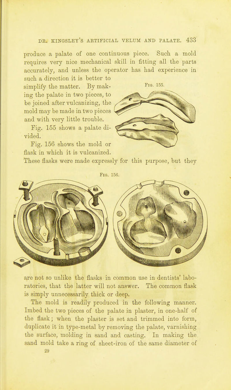 Fig. 155. produce a palate of one continuous piece. Such a mold requires very nice mechanical skill in fitting all the parts accurately, and unless the operator has had experience in such a direction it is better to simplify the matter. By mak- ing the palate in two pieces, to be joined after vulcanizing, the mold may be made in two pieces and with very little trouble. Fig. 155 shows a palate di- vided. Fig. 156 shows the mold or flask in which it is vulcanized. These flasks were made expressly for this purpose, but they Fig. 156. are not so unlike the flasks in common use in dentists' labo- ratories, that the latter will not answer. The common flask is simply unnecessarily thick or deep. The mold is readily produced in the following manner. Imbed the two pieces of the palate in plaster, in one-half of the flask; when the plaster is set and trimmed into form, duplicate it in type-metal by removing the palate, varnishing the surface, molding in sand and casting. In making the sand mold take a ring of sheet-iron of the same diameter of 29