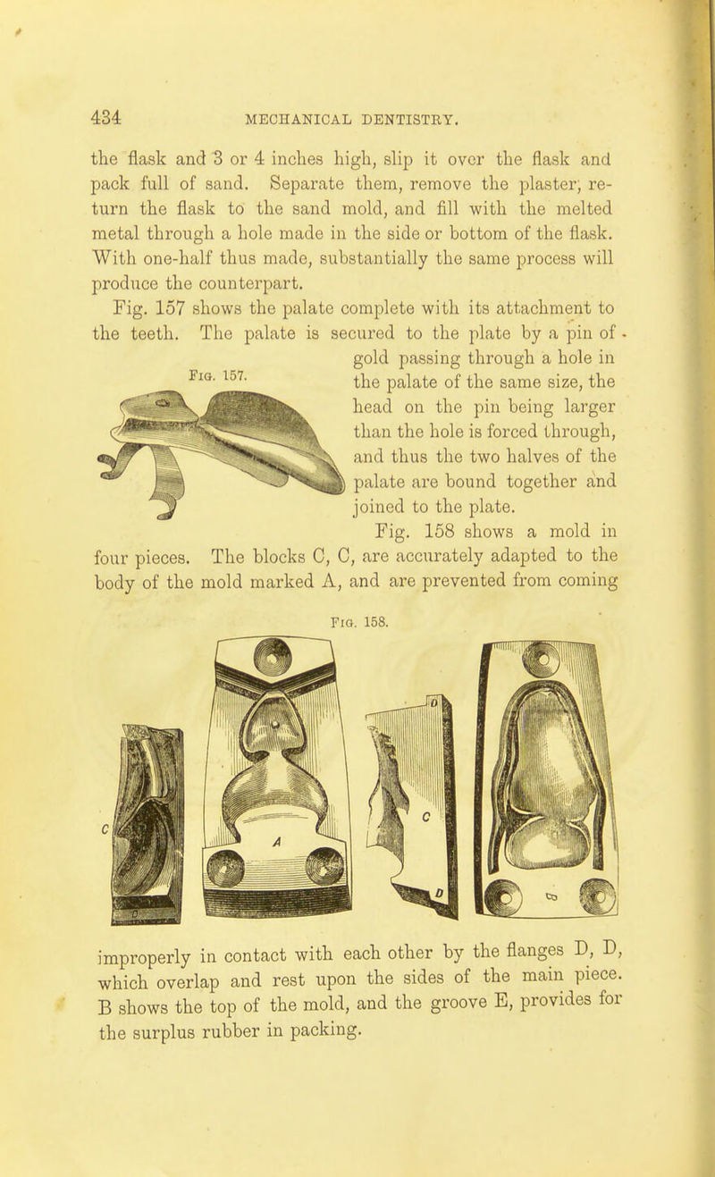 the flask and 3 or 4 inches high, slip it over the flask and pack full of sand. Separate them, remove the plaster, re- turn the flask to the sand mold, and fill with the melted metal through a hole made in the side or bottom of the flask. With one-half thus made, substantially the same process will produce the counterpart. Fig. 157 shows the palate complete with its attachment to the teeth. The palate is secured to the plate by a pin of ■ gold passing through a hole in the palate of the same size, the head on the pin being larger than the hole is forced through, and thus the two halves of the palate are bound together and joined to the plate. Fig. 158 shows a mold in four pieces. The blocks C, C, are accurately adapted to the body of the mold marked A, and are prevented from coming Fig. 157. Fig. 158. improperly in contact with each other by the flanges D, D, which overlap and rest upon the sides of the main piece. B shows the top of the mold, and the groove E, provides for the surplus rubber in packing.