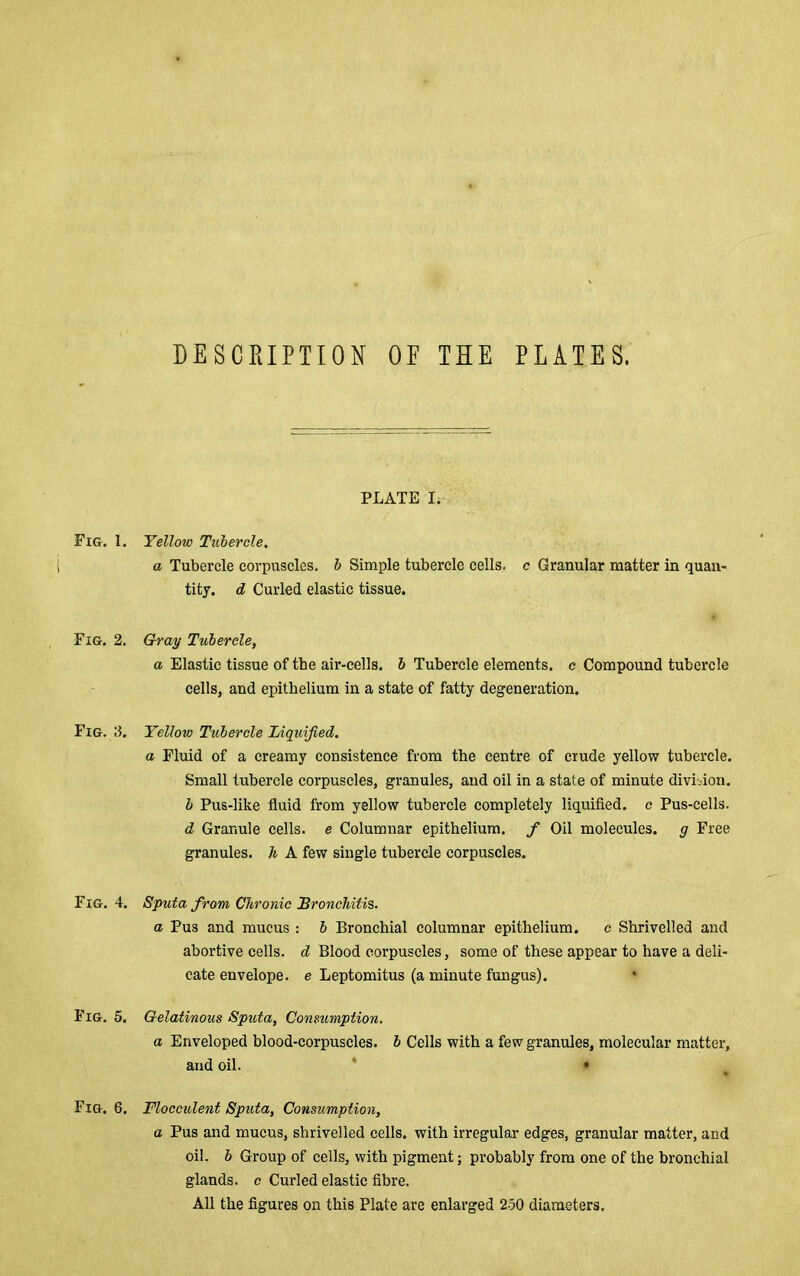 DESCRIPTION OF THE PLATES. Fig. 1, Fig. 2, Fig. 3, Fig. 4 Fig. 5, Fig. 6, PLATE I. Yellow Tubercle, a Tubercle corpuscles, h Simple tubercle eells. c Granular matter in quan- tity. d Curled elastic tissue. Gray Tubercle, a Elastic tissue of the air-cells, h Tubercle elements, e Compound tubercle cells, and epithelium in a state of fatty degeneration. Yellow Tubercle Idquijied. a Fluid of a creamy consistence from the centre of crude yellow tubercle. Small tubercle corpuscles, granules, and oil in a state of minute division. b Pus-like fluid from yellow tubercle completely liquified, c Pus-cells. d Granule eells. e Columnar epithelium, f Oil molecules, g Free granules. Ji A few single tubercle corpuscles. . Sputa from Chronic JBroncTiiti?,. a Pus and mucus : b Bronchial columnar epithelium, c Shrivelled and abortive cells, d Blood corpuscles, some of these appear to have a deli- cate envelope, e Leptomitus (a minute fungus). Gelatinous Sputa, Consumption. a Enveloped blood-corpuscles, h Cells with a few granules, molecular matter, and oil. * • , Flocculent Sputa, Consumption, a Pus and mucus, shrivelled cells, with irregular edges, granular matter, and oil. b Group of eells, with pigment; probably from one of the bronchial glands, c Curled elastic fibre. All the figures on this Plate are enlarged 2-50 diameters.