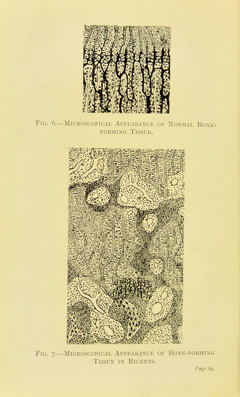 Tissue in Rickets. Page 69.