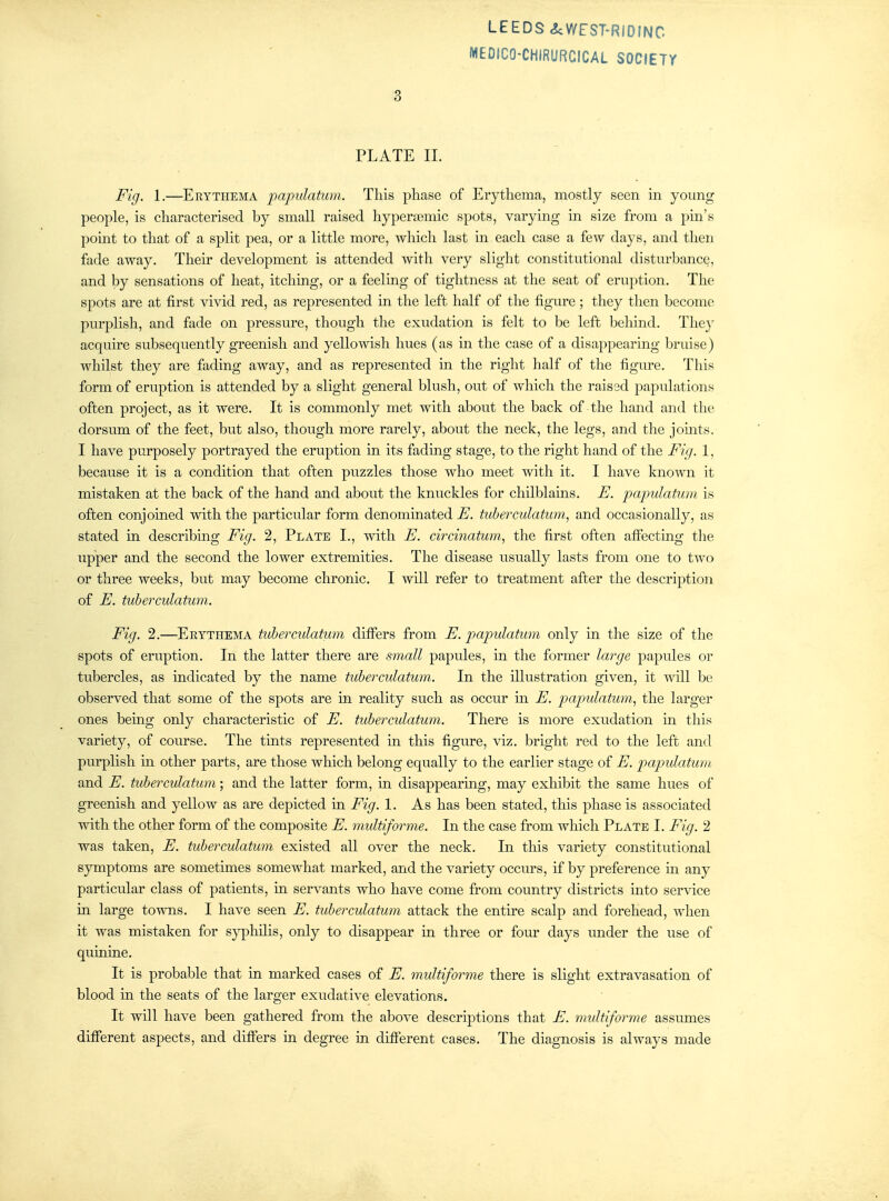 MEDICO-CHIRURCICAL SOCIETY 3 PLATE 11. Fig. 1.—Erythema papulatum. This phase of Erythema, mostly seen in young people, is characterised by small raised hyperaemic spots, varying in size from a pin's pomt to that of a split pea, or a little more, which last in each case a few days, and then fade away. Their development is attended with very slight constitutional disturbance, and by sensations of heat, itching, or a feeling of tightness at the seat of eru})tion. The spots are at first vivid red, as represented in the left half of the figure; they then become purplish, and fade on pressure, though the exudation is felt to be left behind. The}' acquire subsequently greenish and yellowish hues (as in the case of a disappearing bruise) whilst they are fading away, and as represented in the right half of the figure. This form of eruption is attended by a slight general blush, out of which the raised papulations often project, as it were. It is commonly met with about the back of the hand and the dorsum of the feet, but also, though more rarely, about the neck, the legs, and the jomts. I have purposely portrayed the eruption in its fading stage, to the right hand of the Fig. 1, because it is a condition that often puzzles those who meet with it. I have known it mistaken at the back of the hand and about the knuckles for chilblains. E. jiapulatum is often conjoined with the particular form denominated E. tuberculatum, and occasionally, as stated in describing Fig. 2, Plate L, with E. circinatum, the first often atFecting the upper and the second the lower extremities. The disease usually lasts from one to two or three weeks, but may become chronic. I will refer to treatment after the description of E. tuberculatum. Fig. 2.—Erythema tuberculatum differs from E. papulatum only in the size of the spots of eruption. In the latter there are small papules, in the former large papules or tubercles, as indicated by the name tuberculatum. In the illustration given, it will be observed that some of the spots are in reality such as occur in E. papulatum, the larger ones being only characteristic of E. tuberculatum. There is more exudation m this variety, of course. The tints represented in this figure, viz. bright red to the left and purplish m other parts, are those which belong equally to the earlier stage of E. papulatum and E. tuberculatum; and the latter form, in disappearing, may exhibit the same hues of greenish and yellow as are depicted in Fig. 1. As has been stated, this phase is associated with the other form of the composite E. multiforme. In the case from which Plate I. Fig. 2 was taken, E. tuberculatum existed all over the neck. In this variety constitutional symptoms are sometimes somewhat marked, and the variety occurs, if by preference m any particular class of patients, in servants who have come from country districts into service in large towns. I have seen E. tuberculatum attack the entire scalp and forehead, when it was mistaken for s}^hilis, only to disappear in three or four days under the use of quinine. It is probable that in marked cases of E. multiforme there is slight extravasation of blood in the seats of the larger exudative elevations. It will have been gathered from the above descriptions that E. multiforme assumes different aspects, and differs in degree in different cases. The diagnosis is always made
