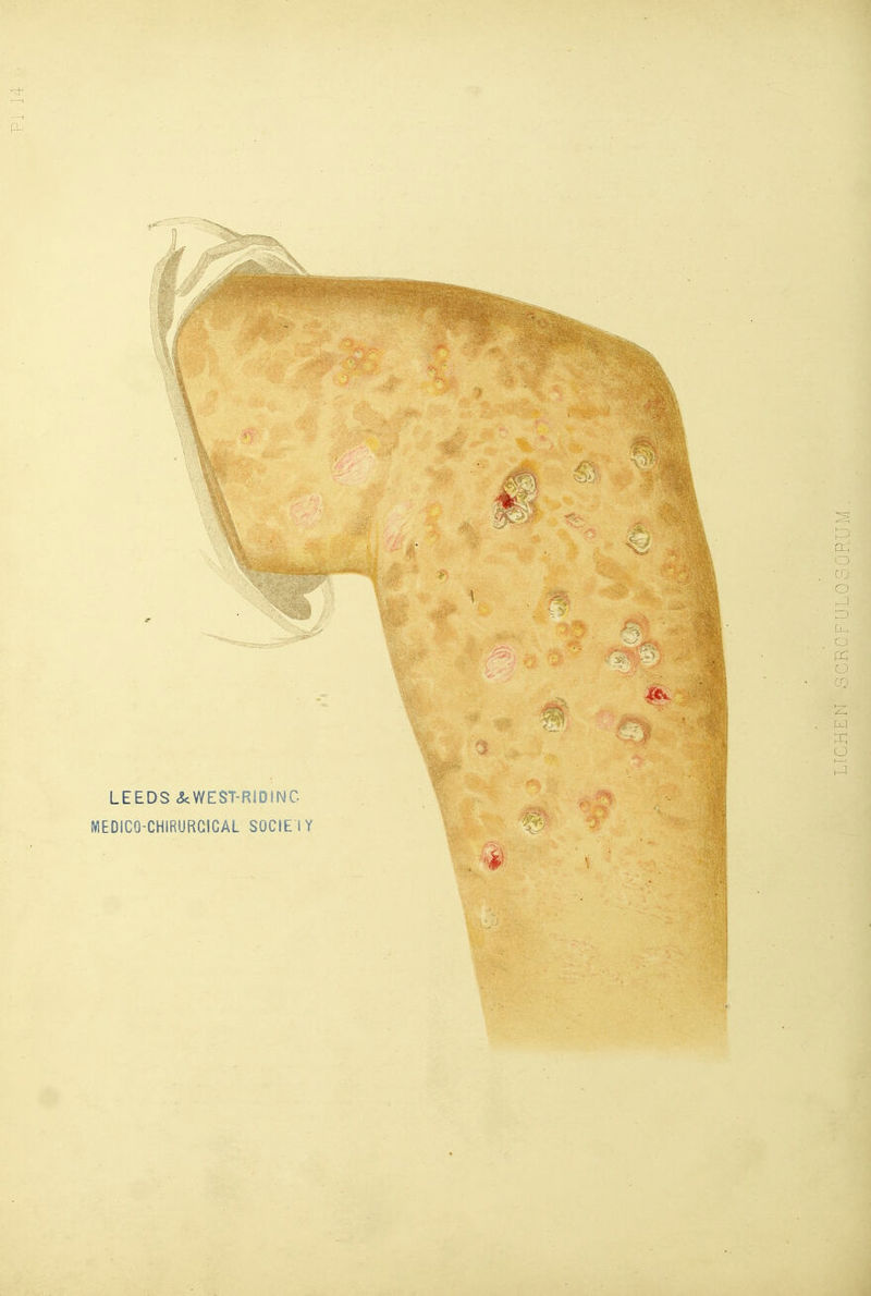 LEEDS .ScWEST-RIDINC. MEDICO-CHIRURGiCAL SOCIE IY